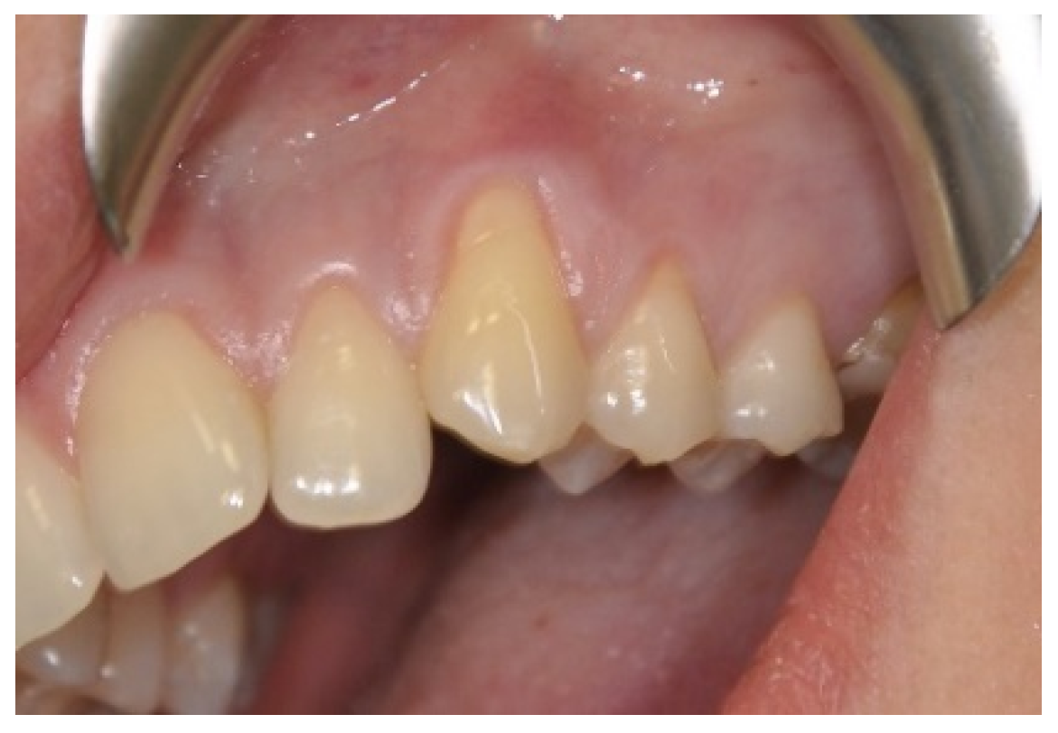 Applsci 11 01081 g002 Applsci 11 01081 g002