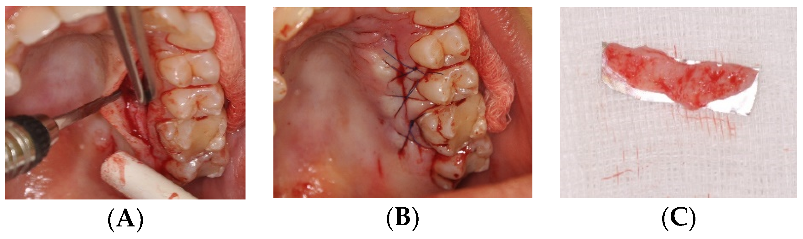 Applsci 11 01081 g007 Applsci 11 01081 g007