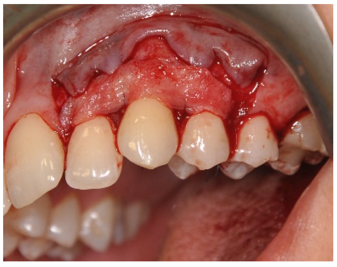 Applsci 11 01081 g008 Applsci 11 01081 g008