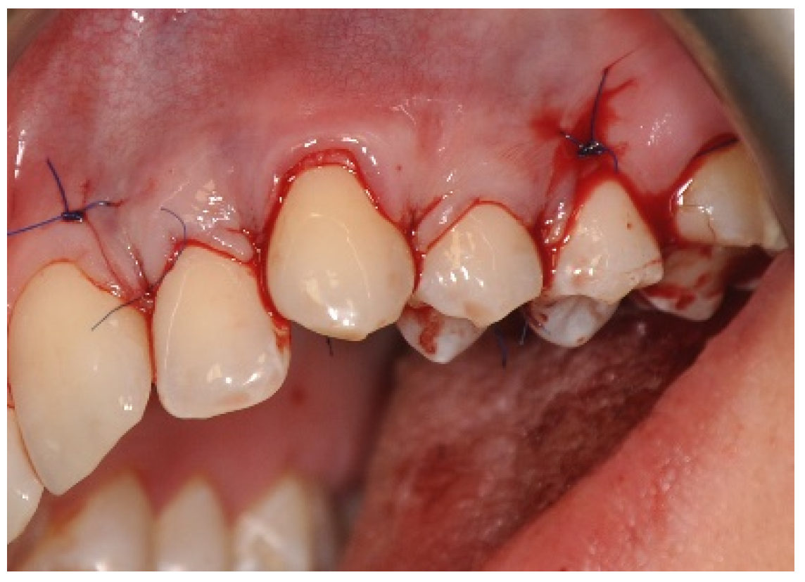 Applsci 11 01081 g009 Applsci 11 01081 g009