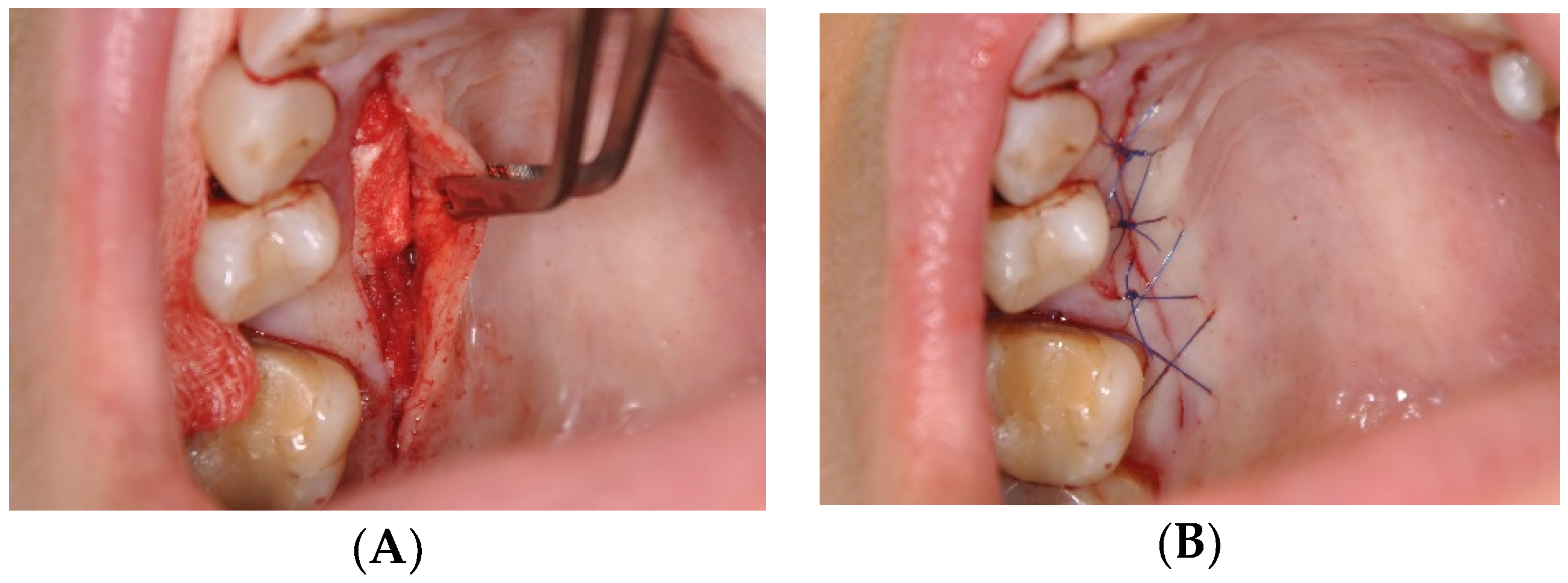 Applsci 11 01081 g010 Applsci 11 01081 g010