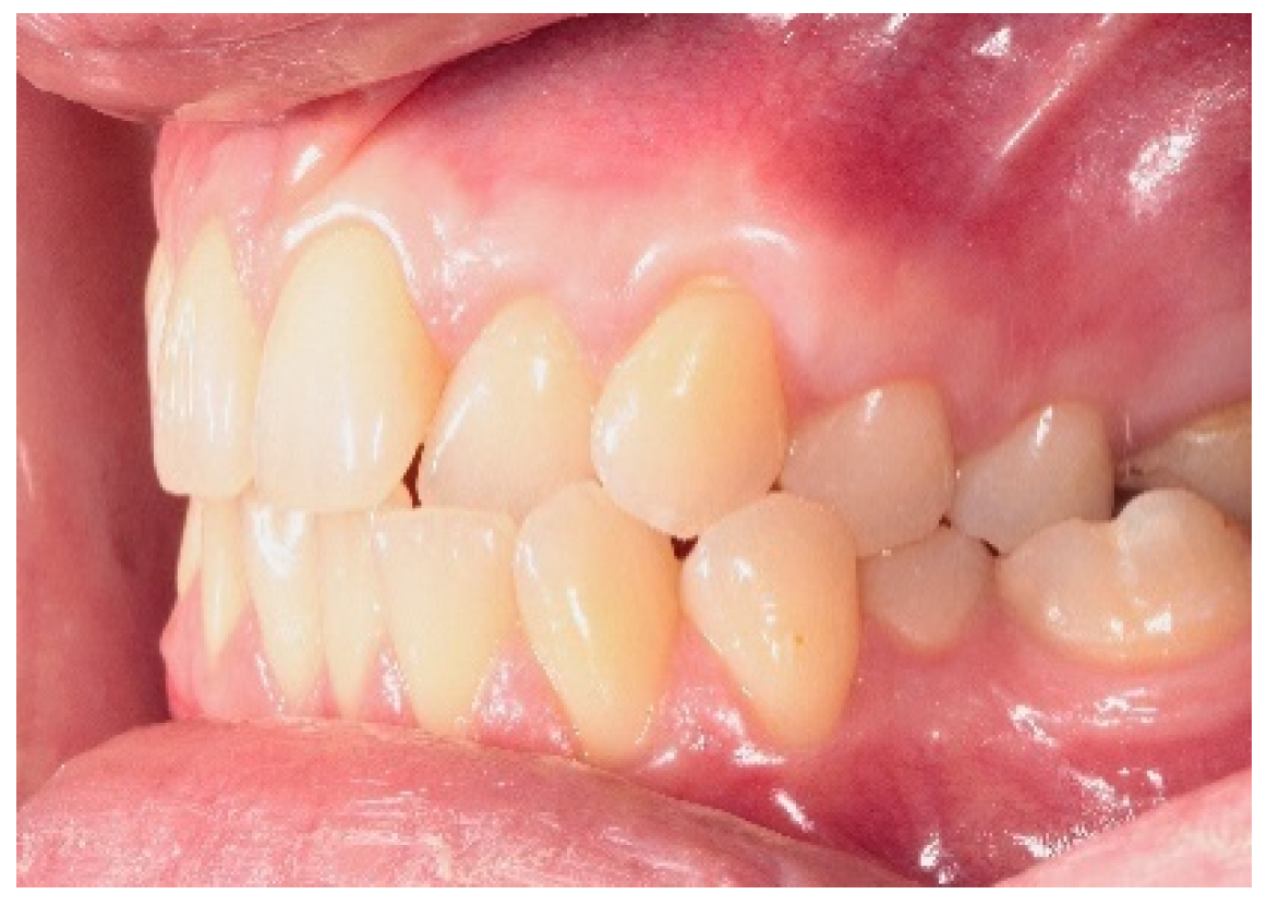 Applsci 11 01081 g011 Applsci 11 01081 g011