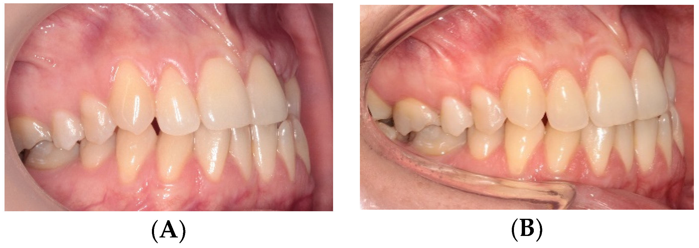 Applsci 11 01081 g012 Applsci 11 01081 g012