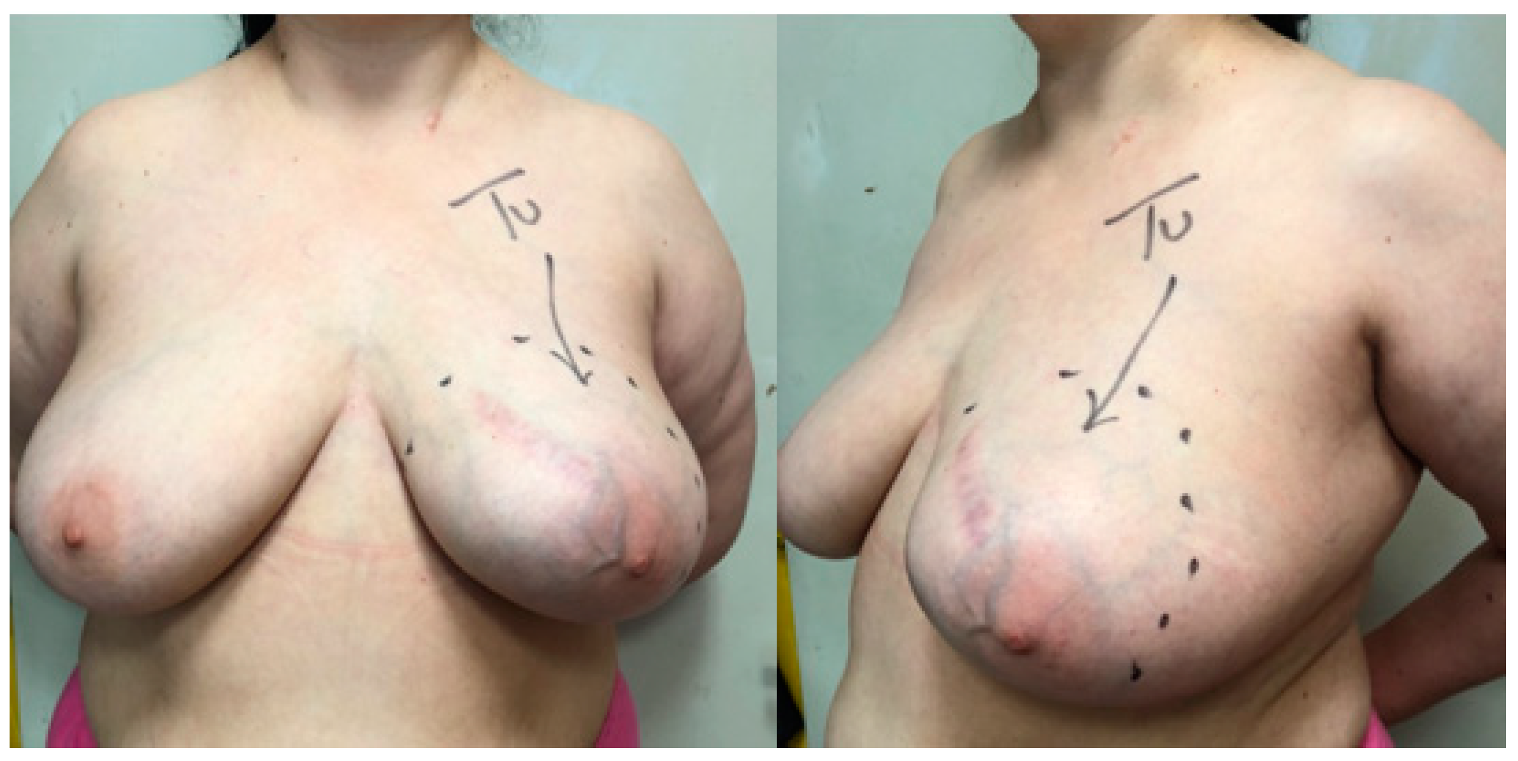 Applsci 11 01224 g003 Applsci 11 01224 g003