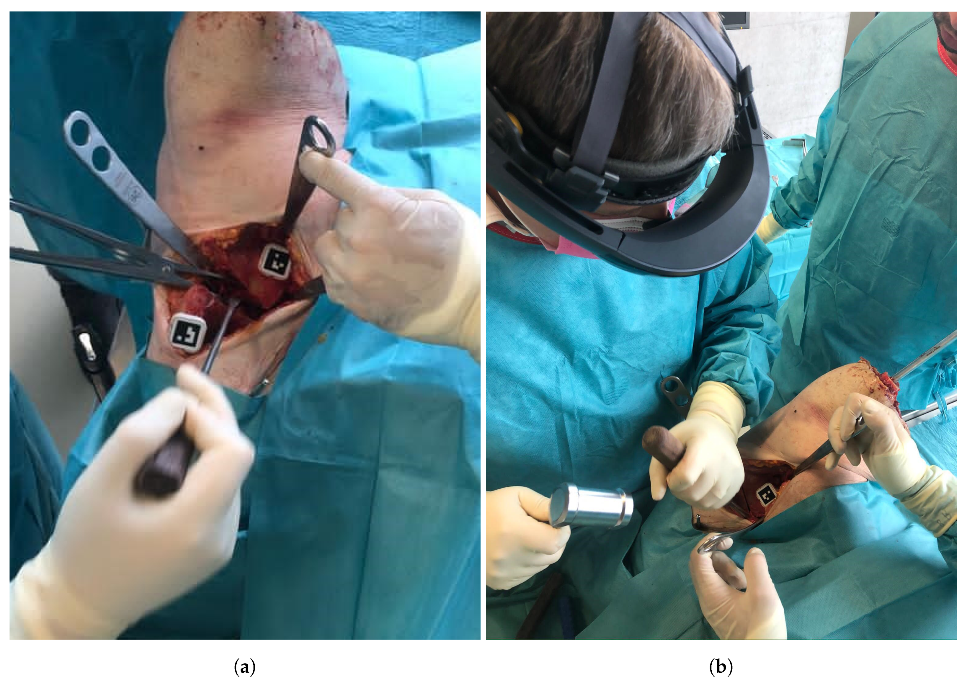 Applsci 11 01228 g004