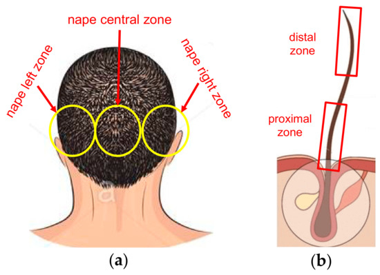Applied Sciences | Free Full-Text | Weekly and Longitudinal Element Variability in Hair Samples of Subjects Non-Occupationally Exposed Applied Sciences | Free Full-Text | Weekly and Longitudinal Element Variability in Hair Samples of Subjects Non-Occupationally Exposed