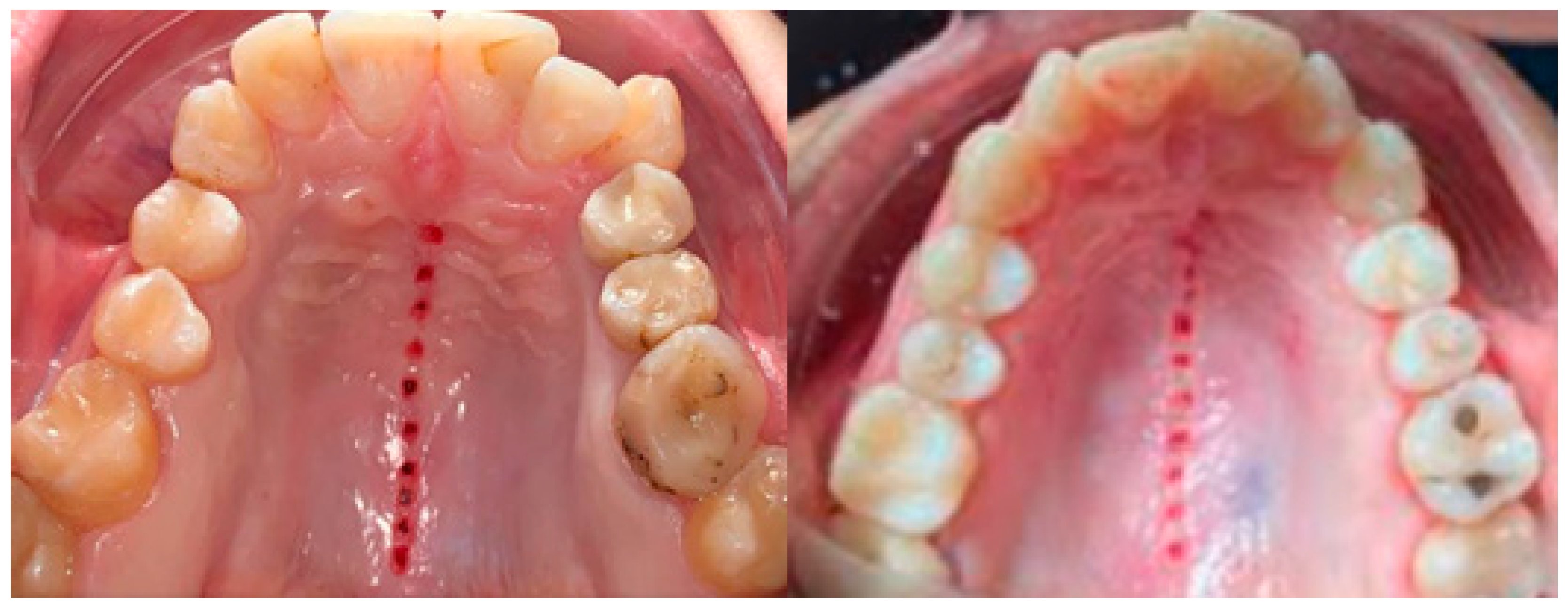 Applsci 11 01306 g001 Applsci 11 01306 g001