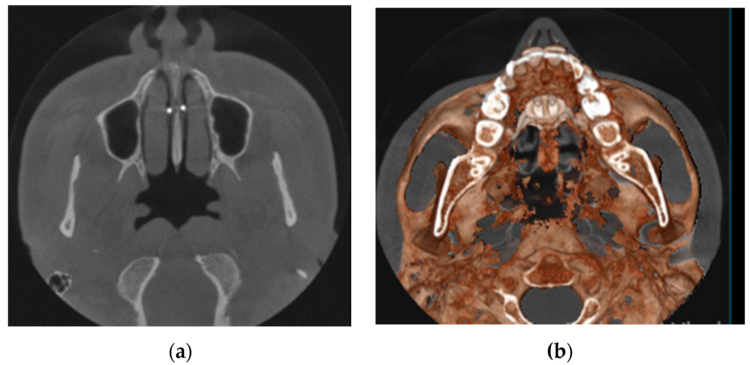 Applsci 11 01306 g005 Applsci 11 01306 g005