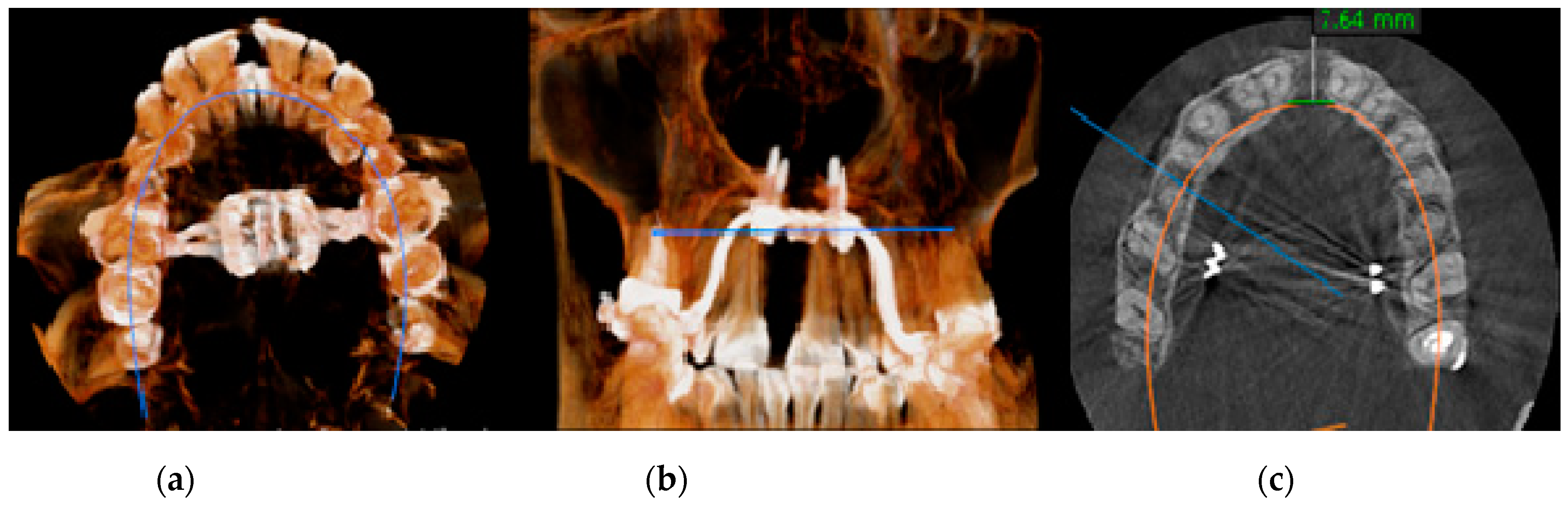 Applsci 11 01306 g006 Applsci 11 01306 g006