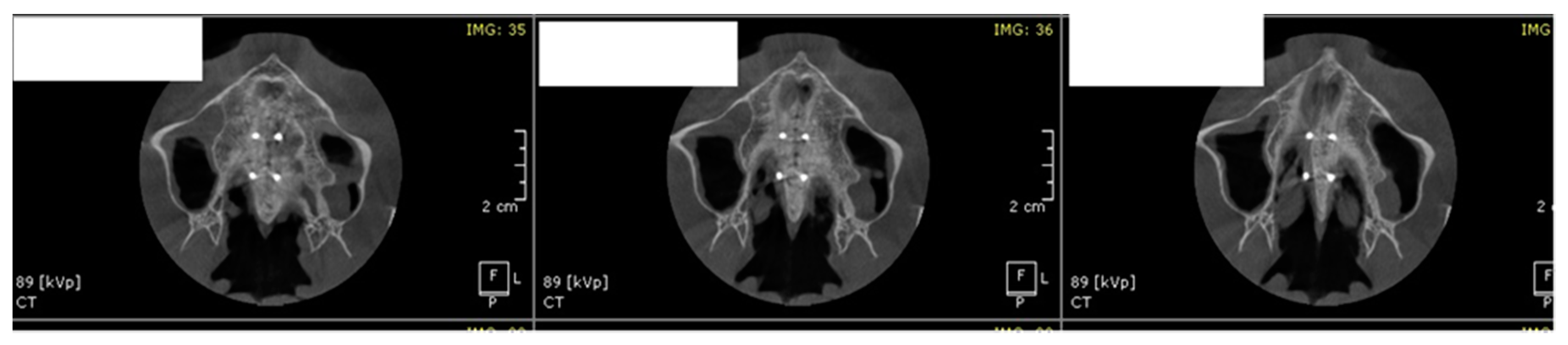 Applsci 11 01306 g007 Applsci 11 01306 g007