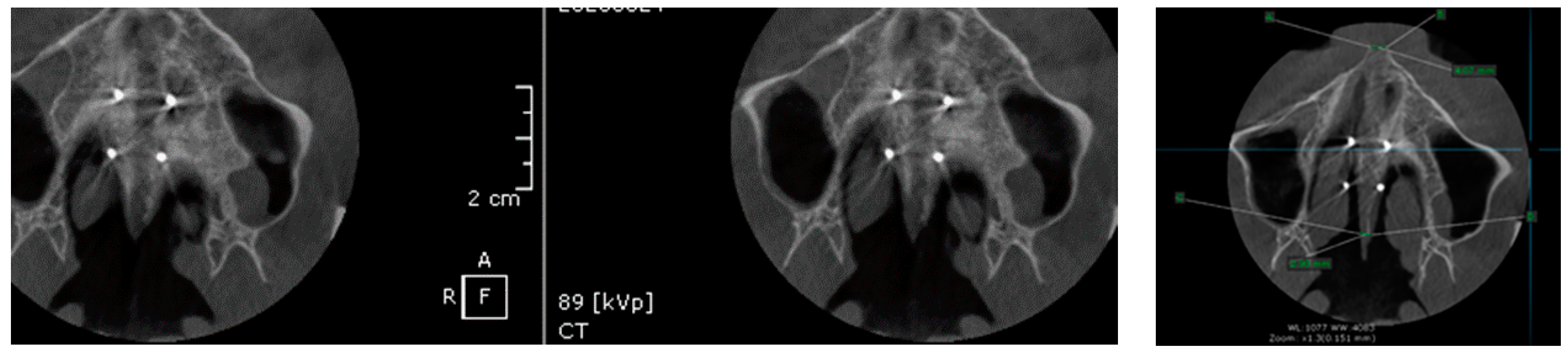 Applsci 11 01306 g008 Applsci 11 01306 g008