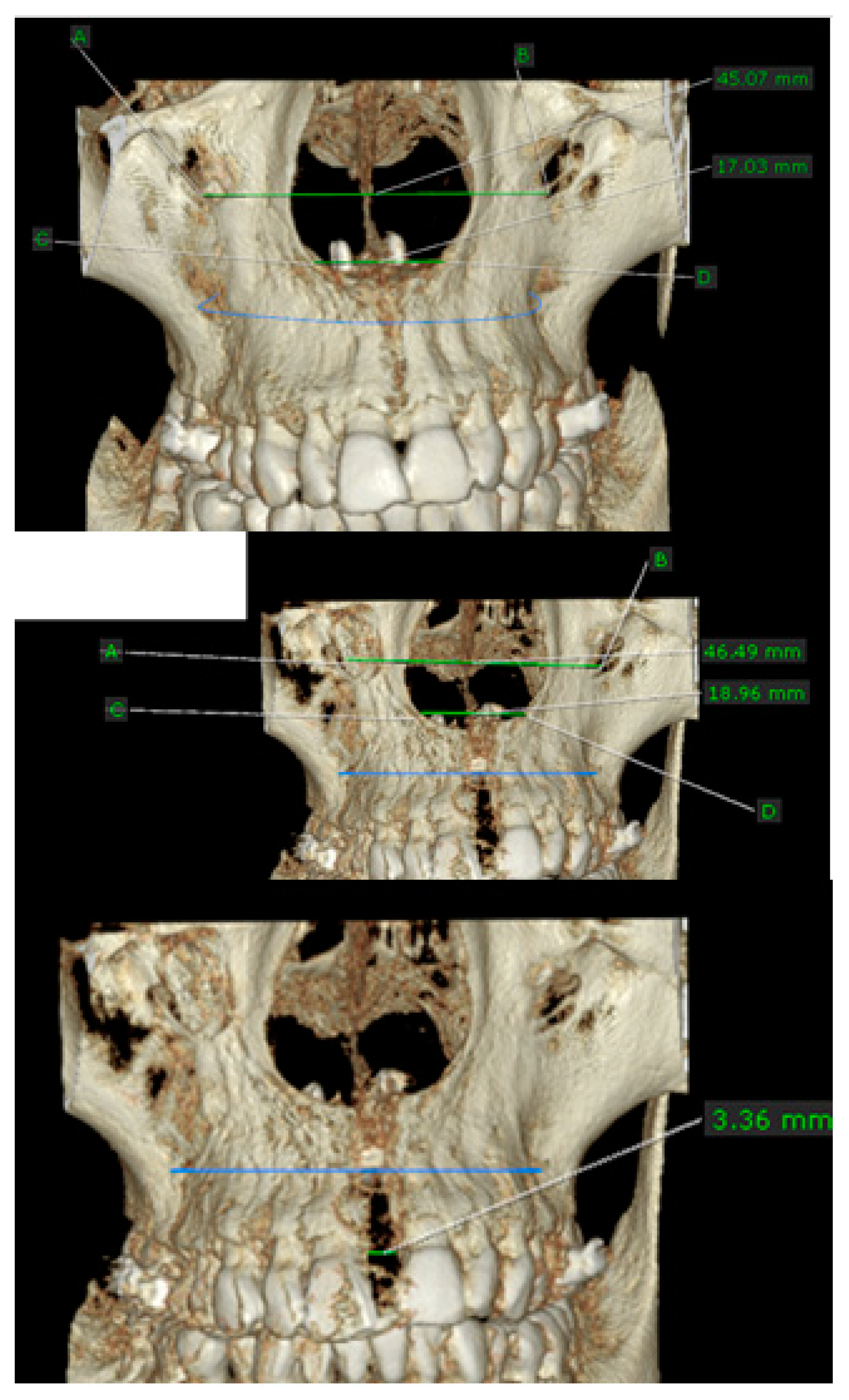 Applsci 11 01306 g010 Applsci 11 01306 g010