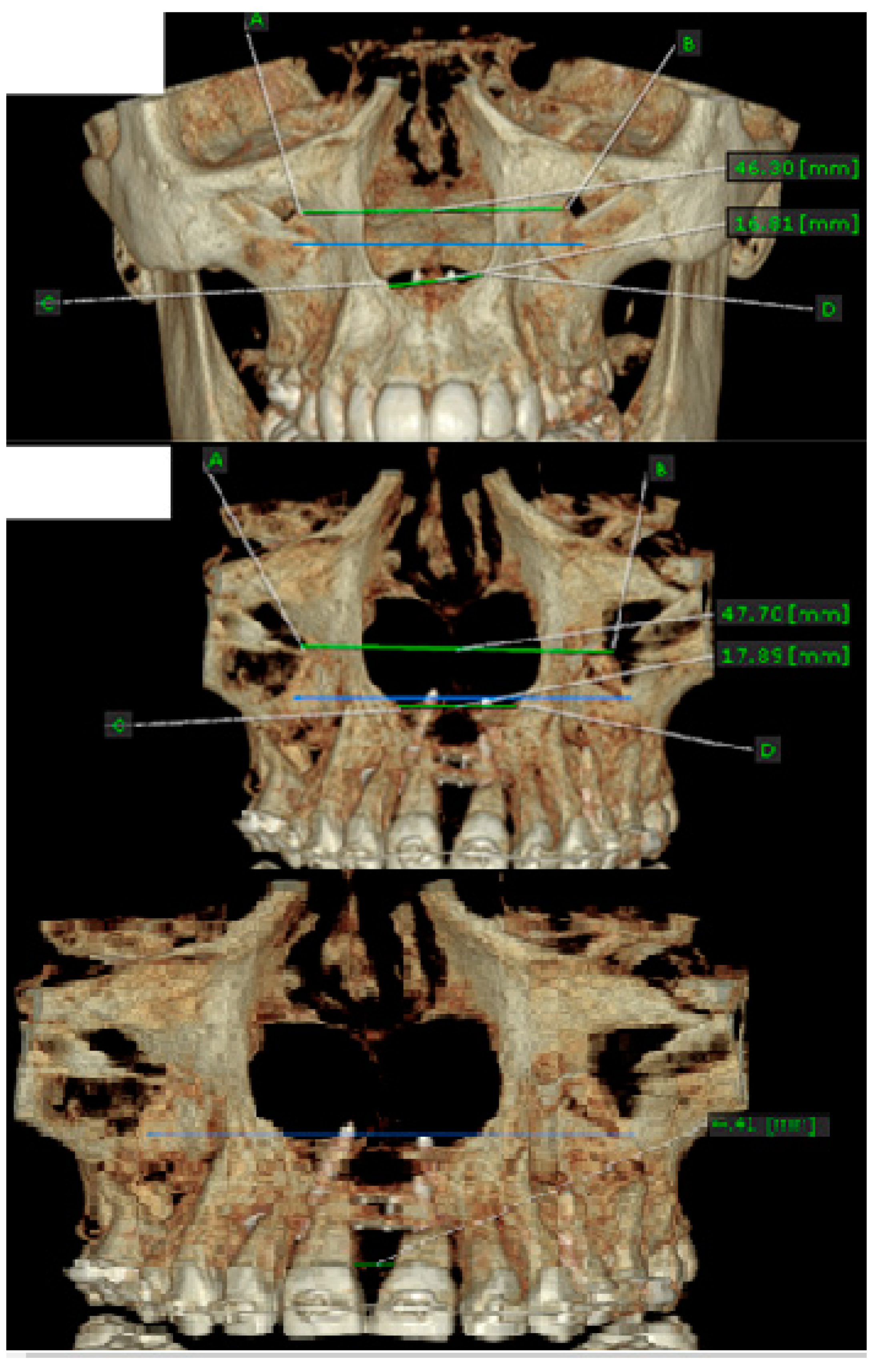 Applsci 11 01306 g011 Applsci 11 01306 g011