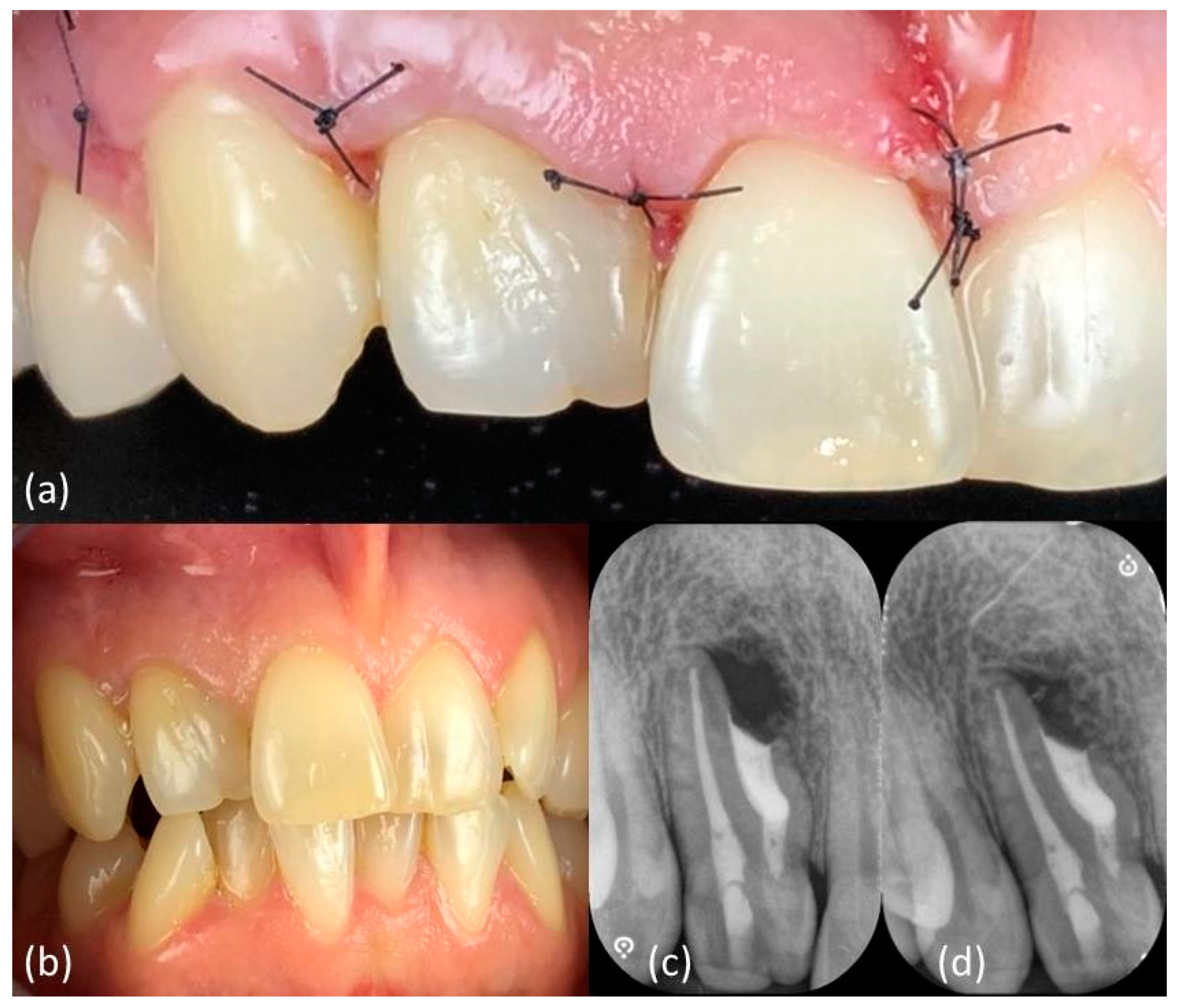 Applsci 11 01511 g005