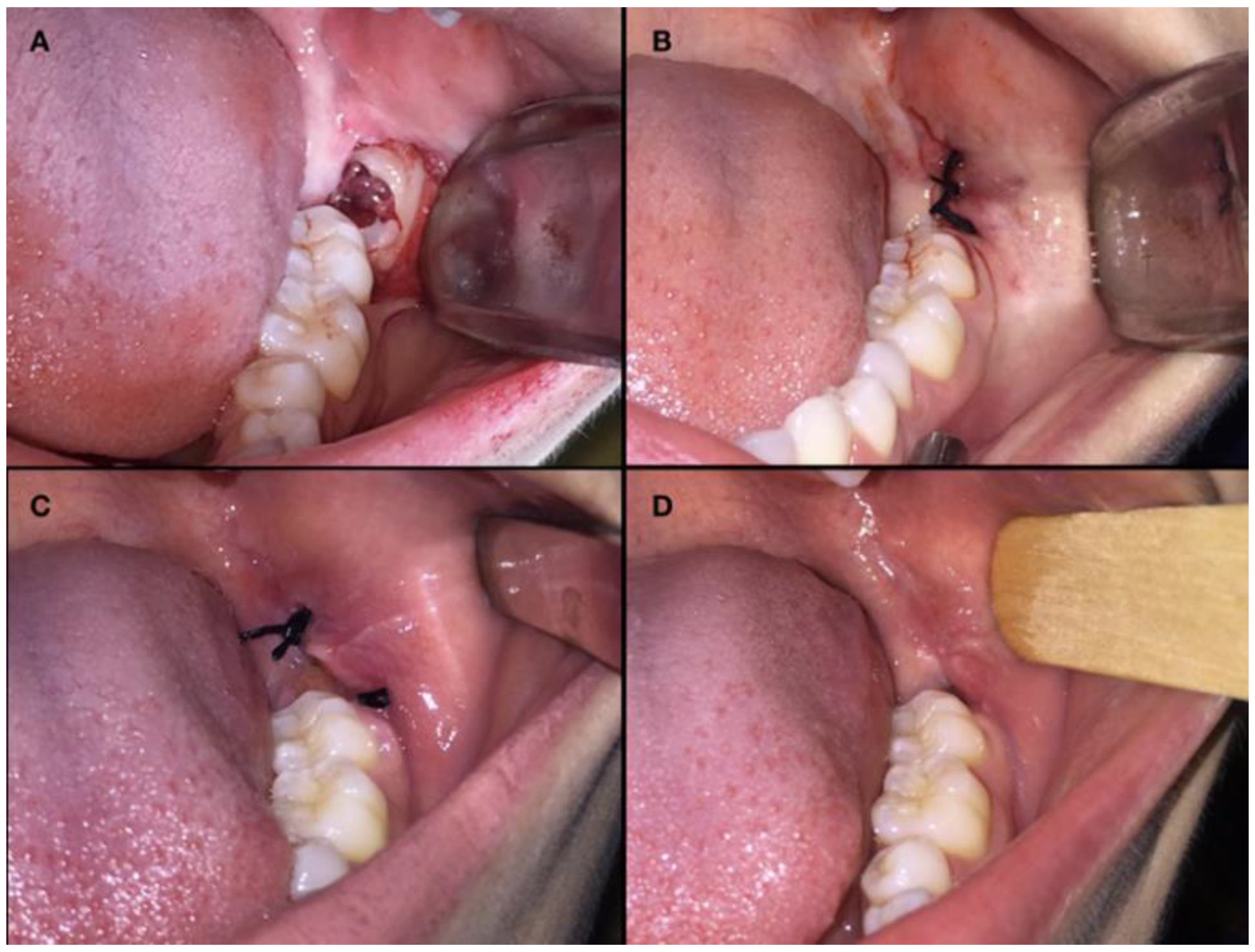 Applsci 11 01666 g003