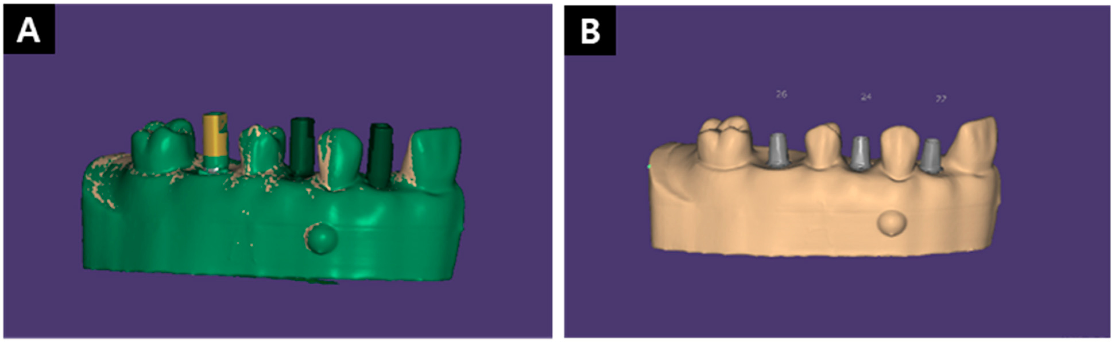 Applsci 11 01689 g004