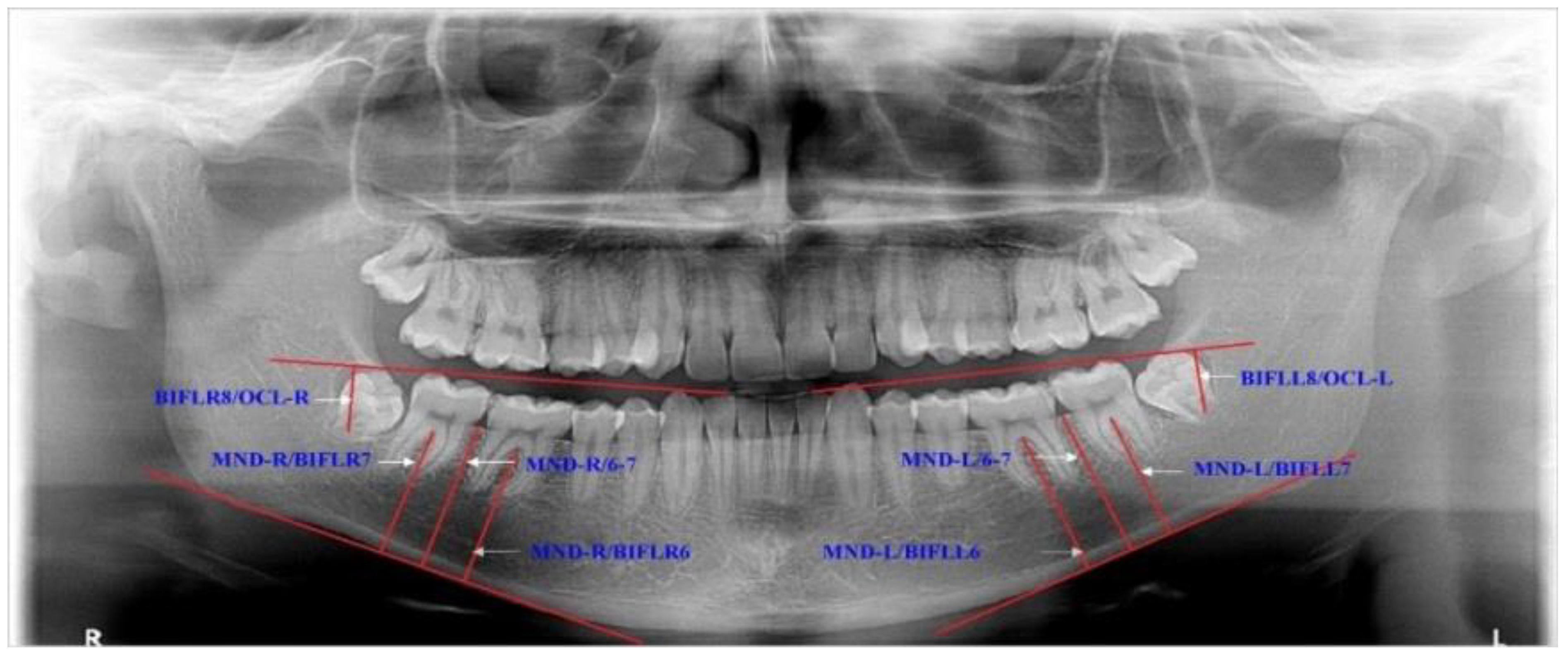 Applsci 11 01824 g002