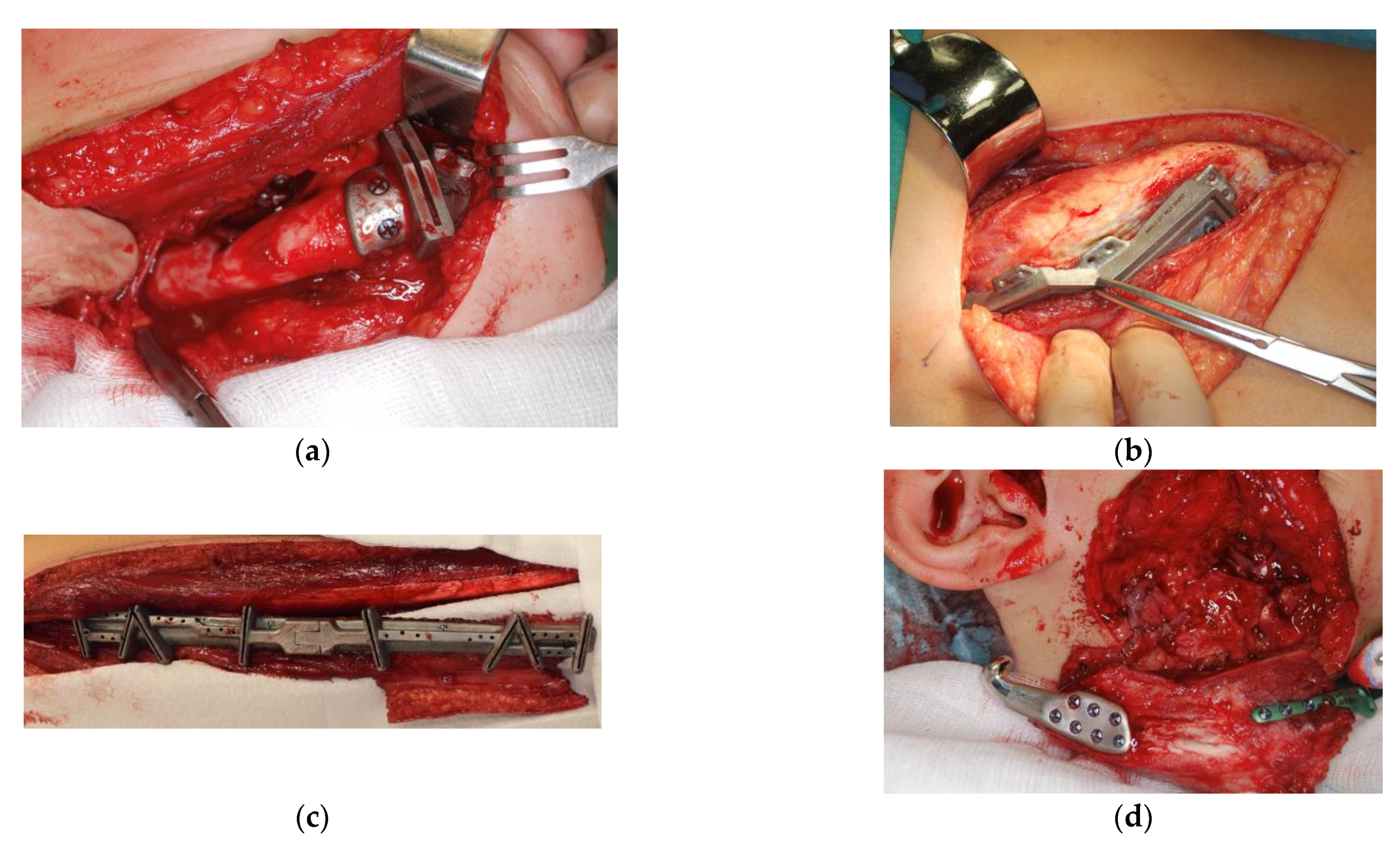 Applsci 11 02176 g002 Applsci 11 02176 g002