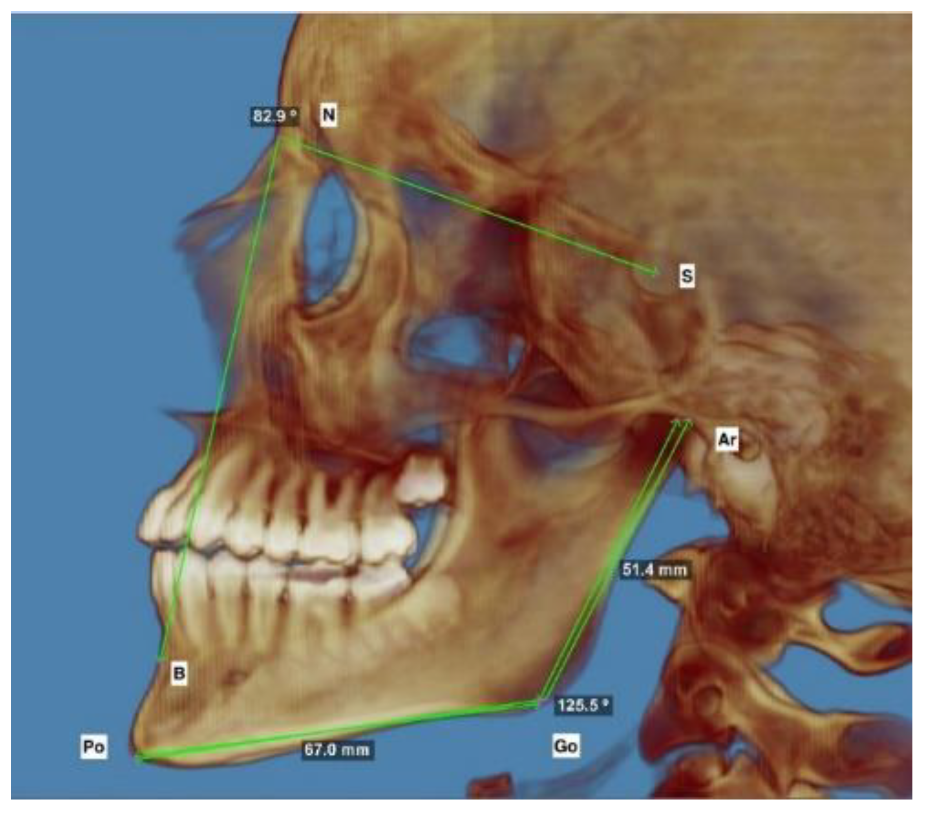 Applsci 11 02176 g003 Applsci 11 02176 g003