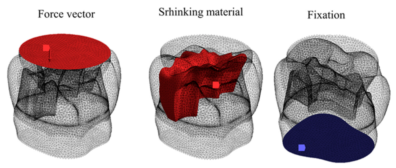 Applsci 11 02215 g003 Applsci 11 02215 g003