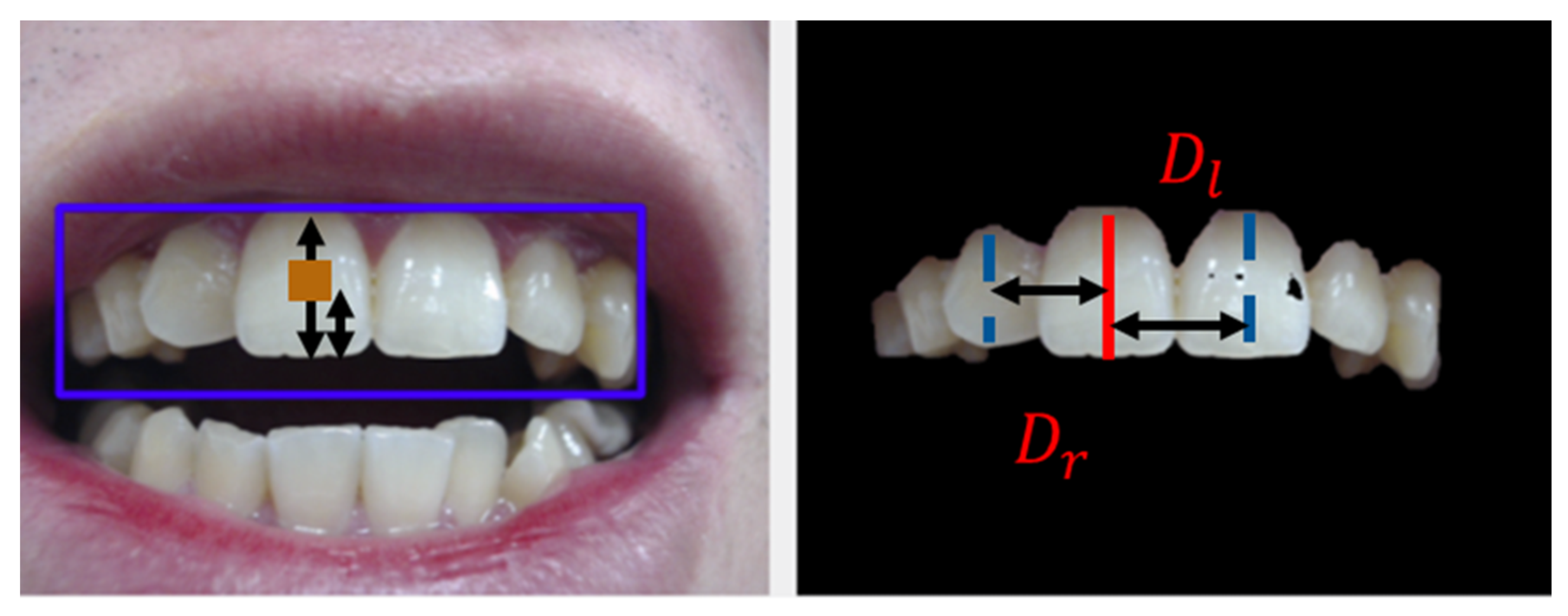 Applsci 11 02315 g005