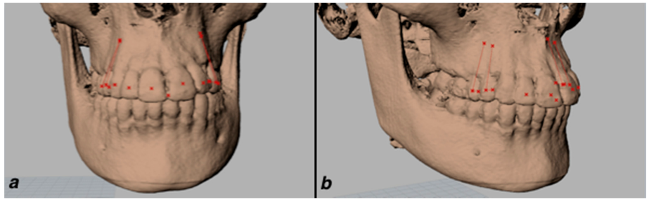 Applsci 11 02374 g002
