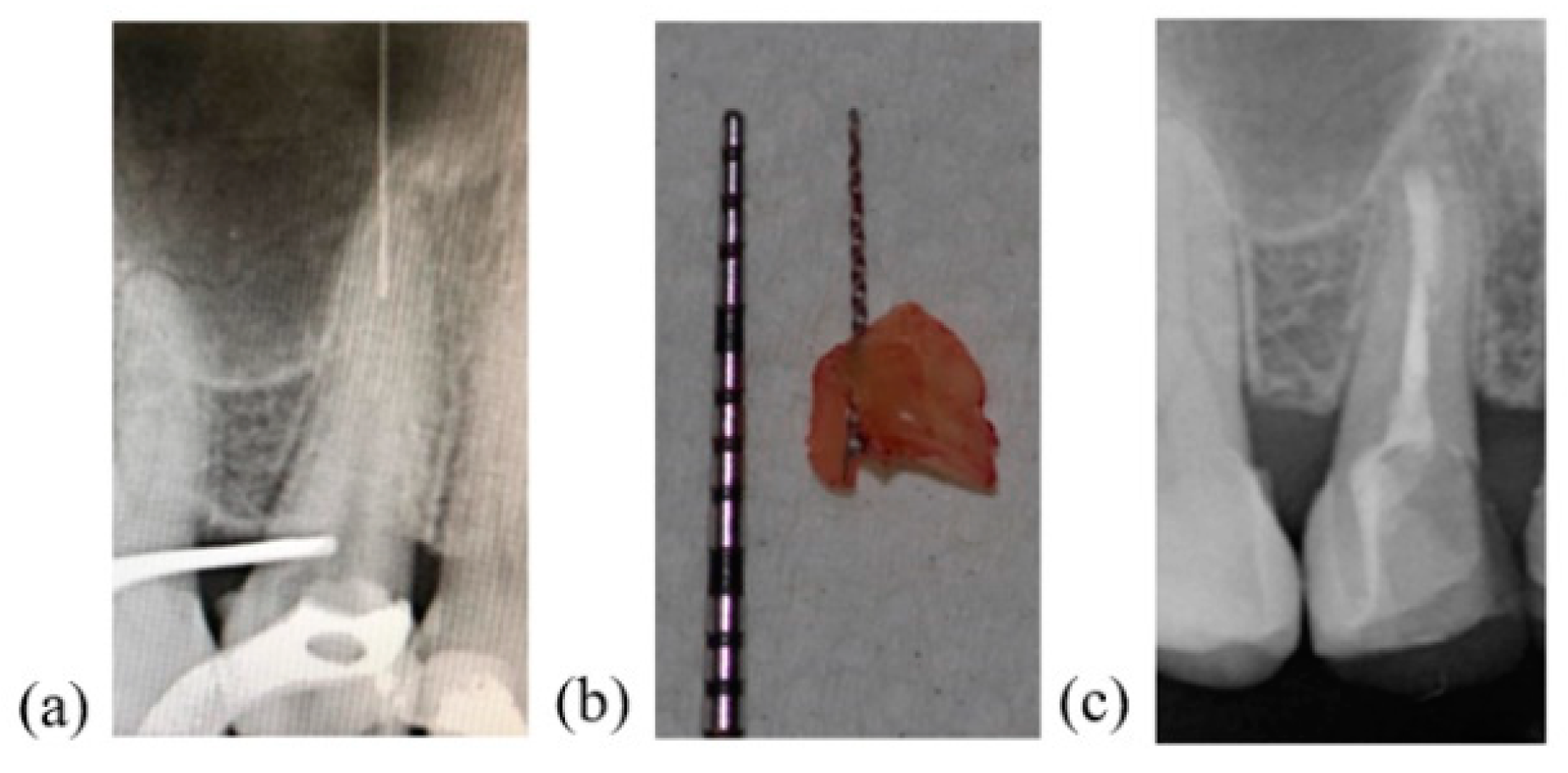 Applsci 11 02602 g004 Applsci 11 02602 g004