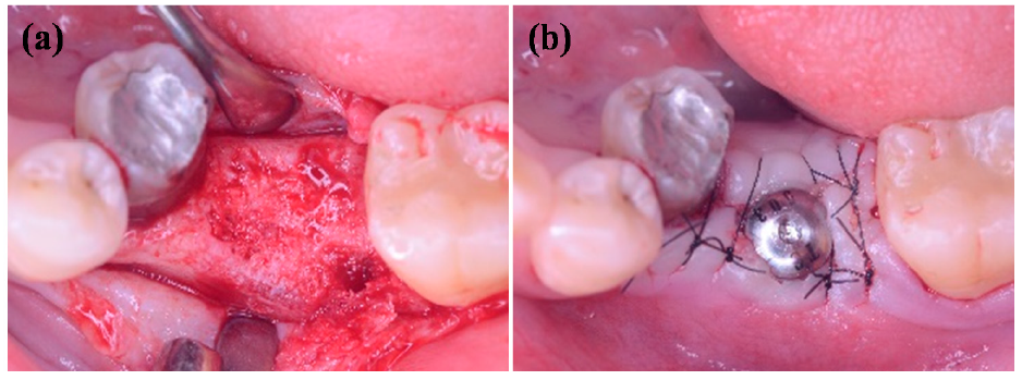 Applsci 11 02616 g001 Applsci 11 02616 g001
