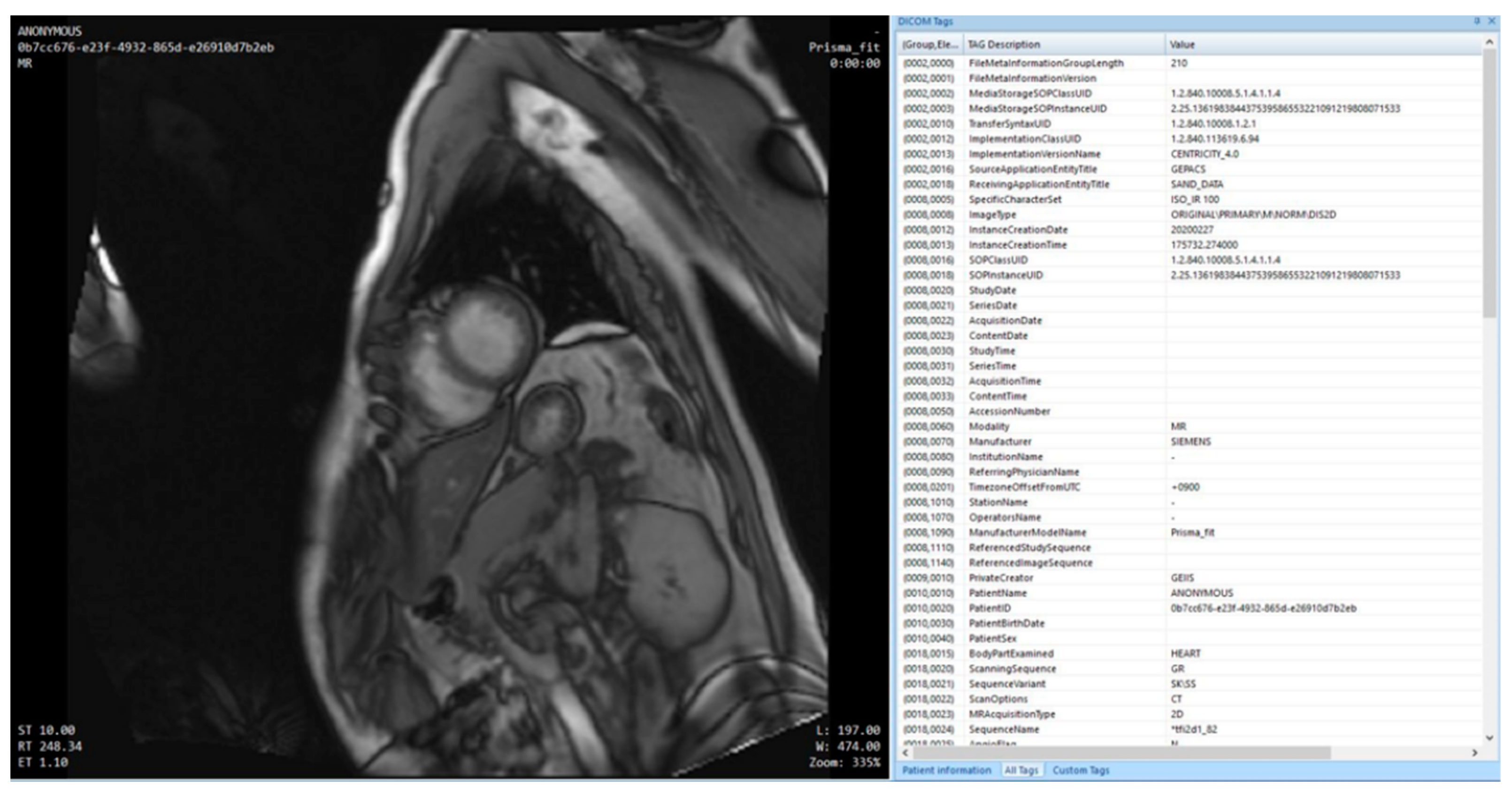 Applsci 11 02704 g011