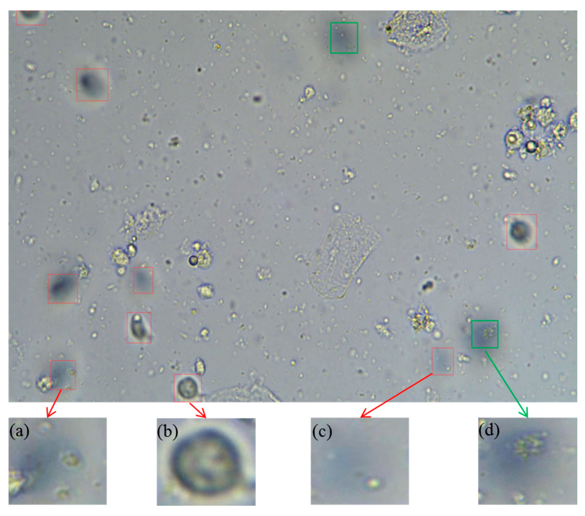 Trichomonas fórum)