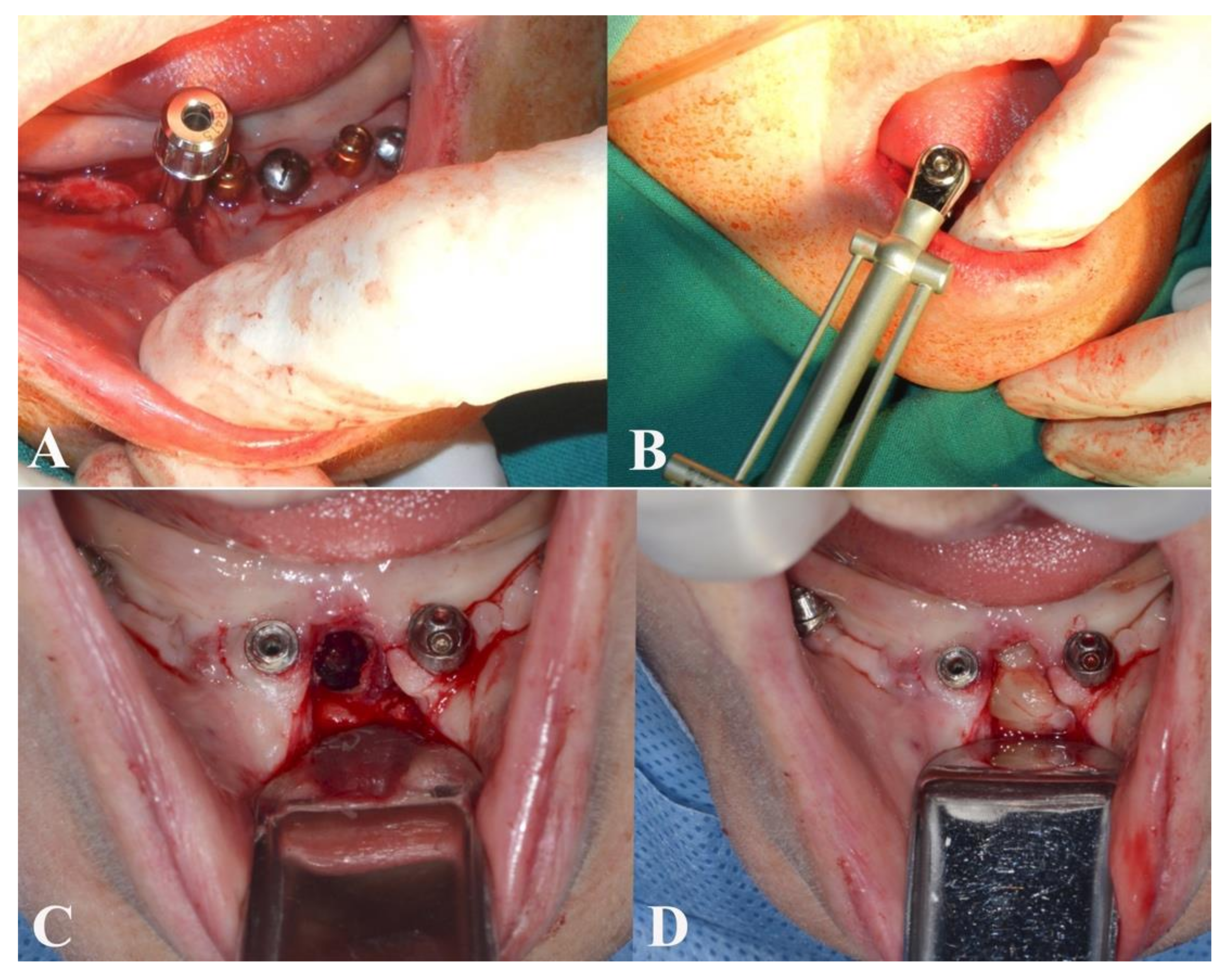 Applsci 11 02766 g001 Applsci 11 02766 g001