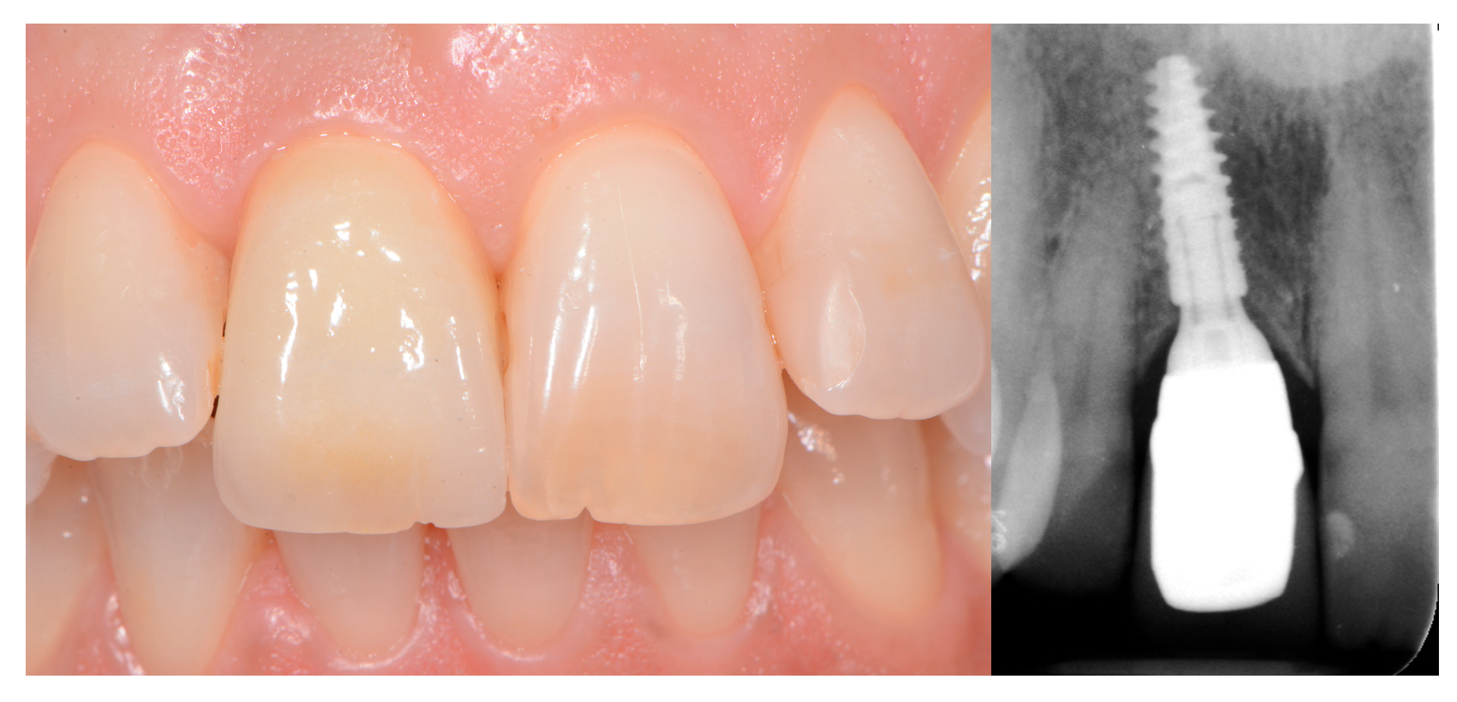 Applsci 11 02957 g002