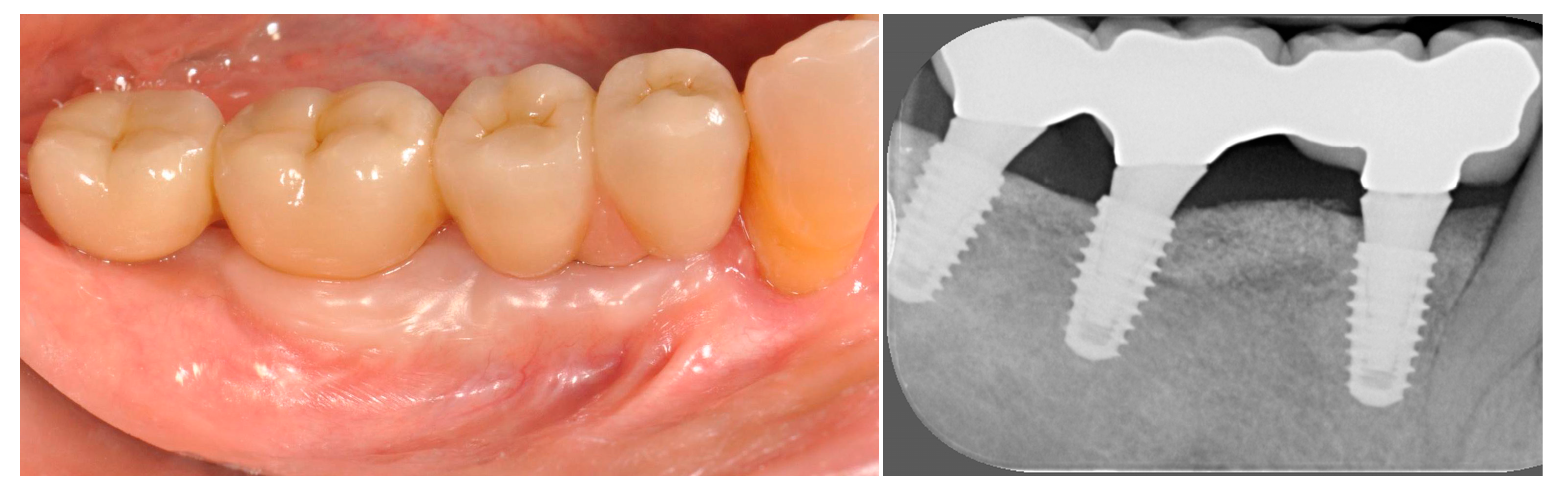 Applsci 11 02957 g003