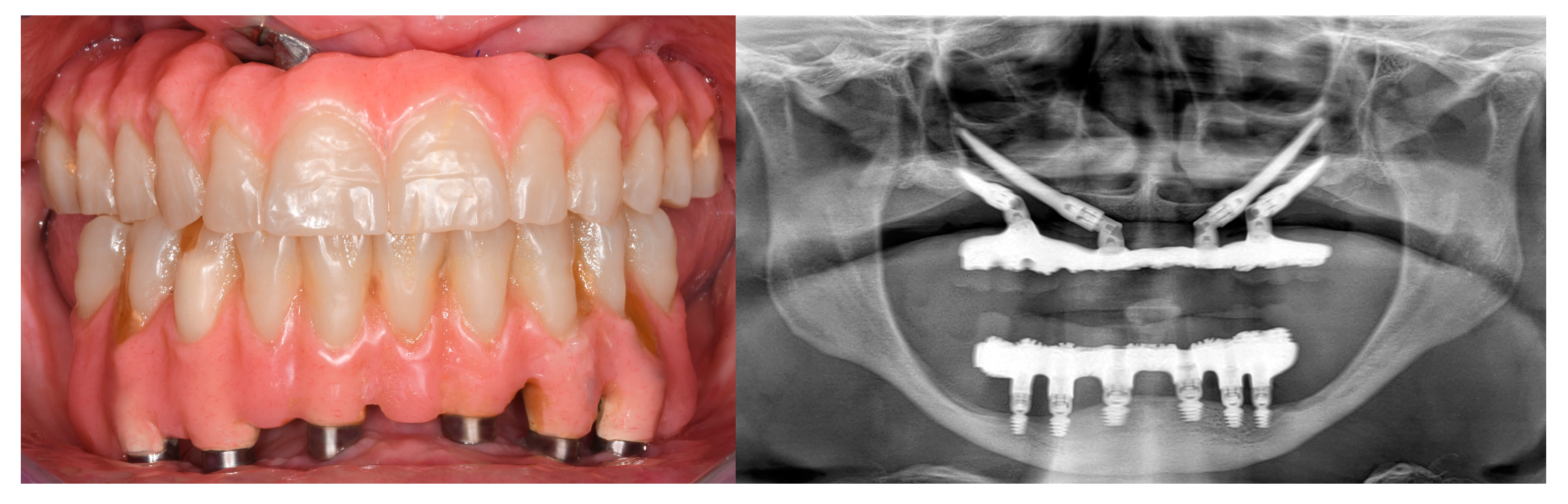 Applsci 11 02957 g004