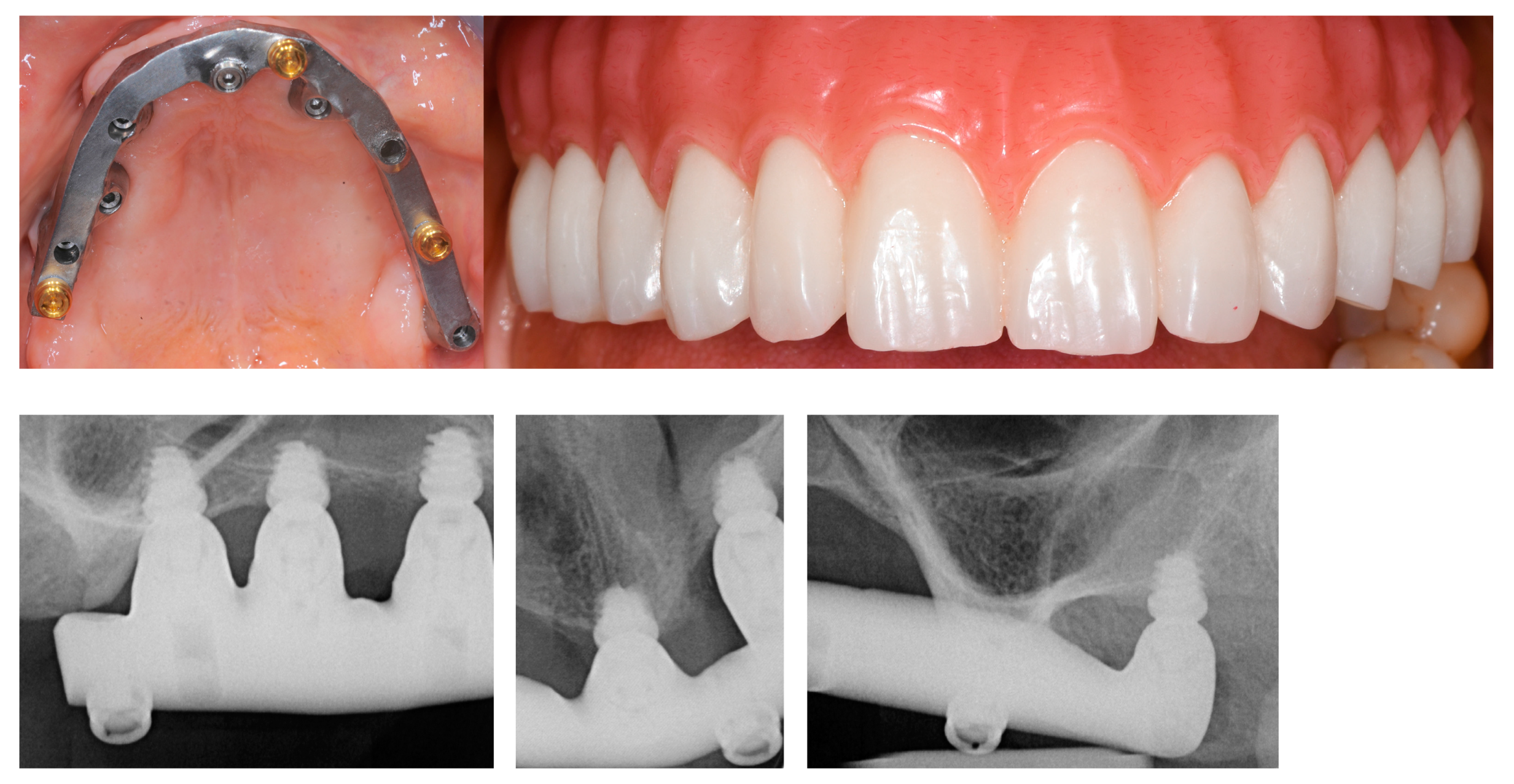 Applsci 11 02957 g005