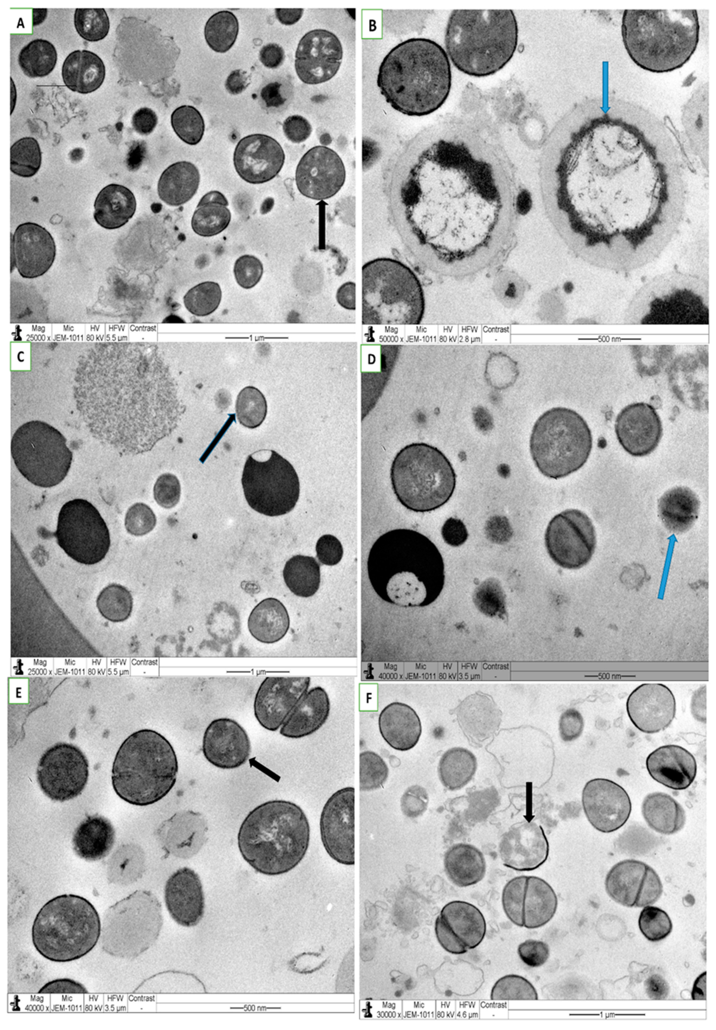 Applsci 11 03206 g005 Applsci 11 03206 g005
