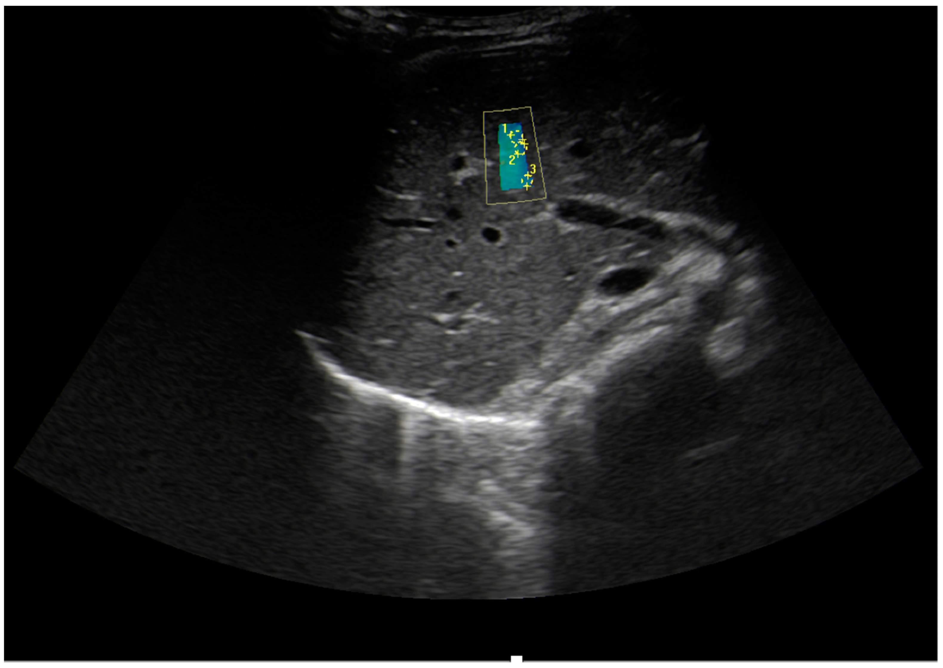 Applsci 11 03240 g002