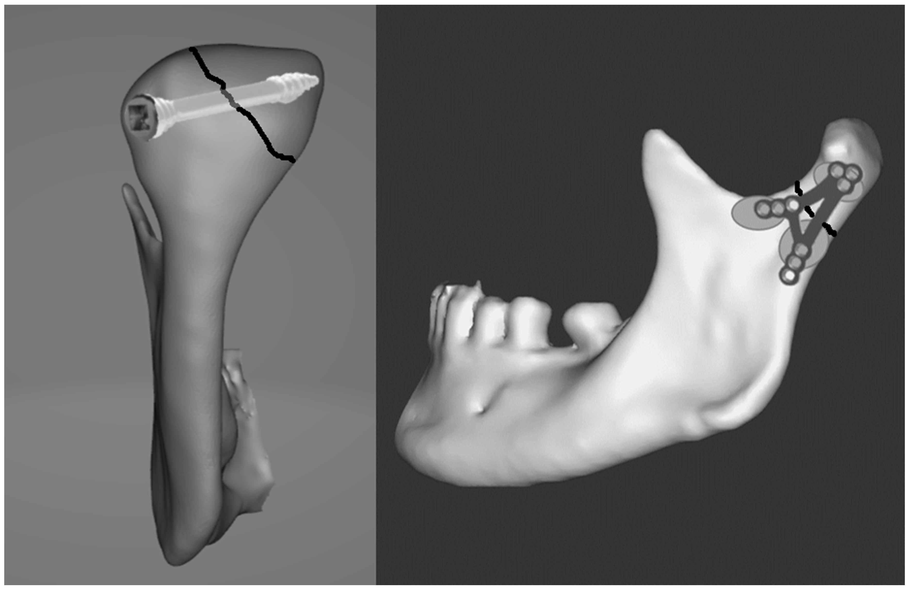 Applsci 11 03371 g005