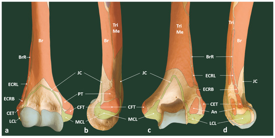 Applied Sciences Free Full Text Ultrasound Guided Procedures In Common Tendinopathies At The Elbow From Image To Needle Html