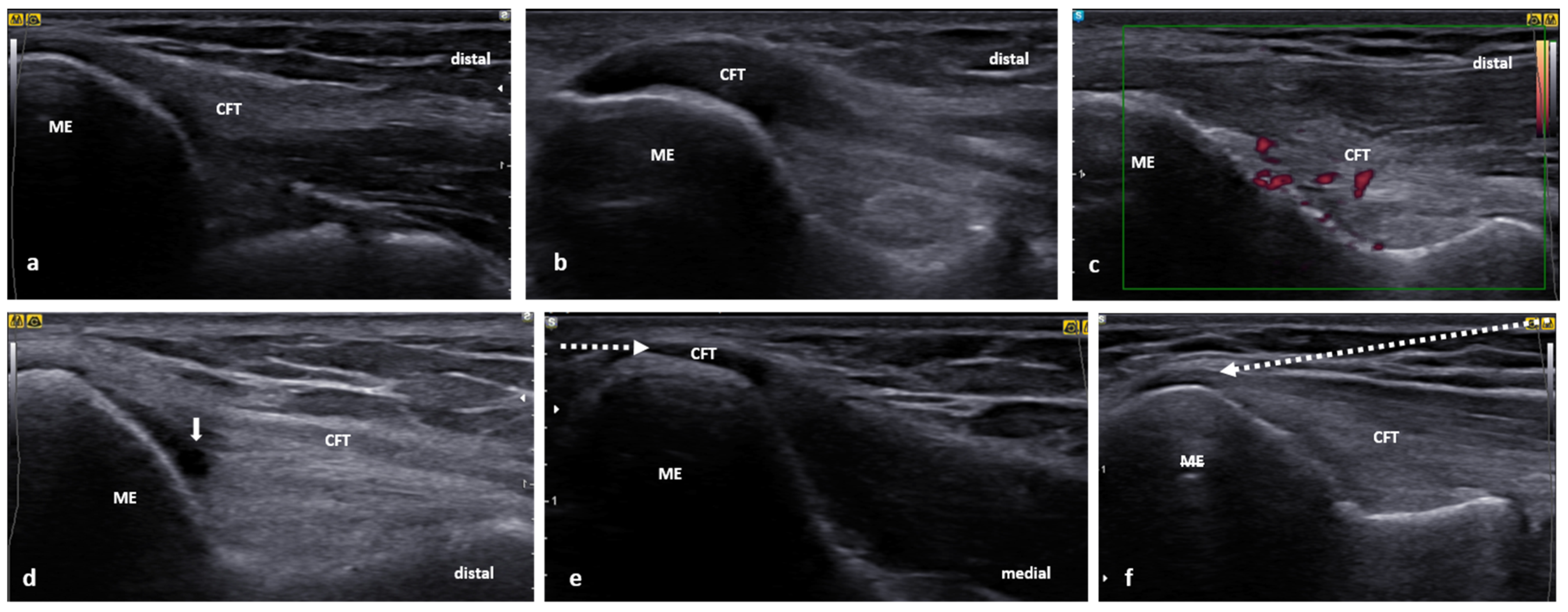 Applsci 11 03431 g006 Applsci 11 03431 g006