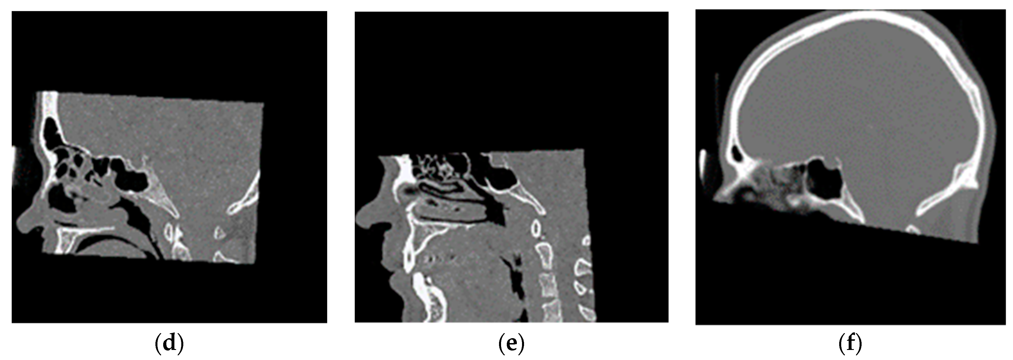 Applsci 11 03508 g002b Applsci 11 03508 g002b