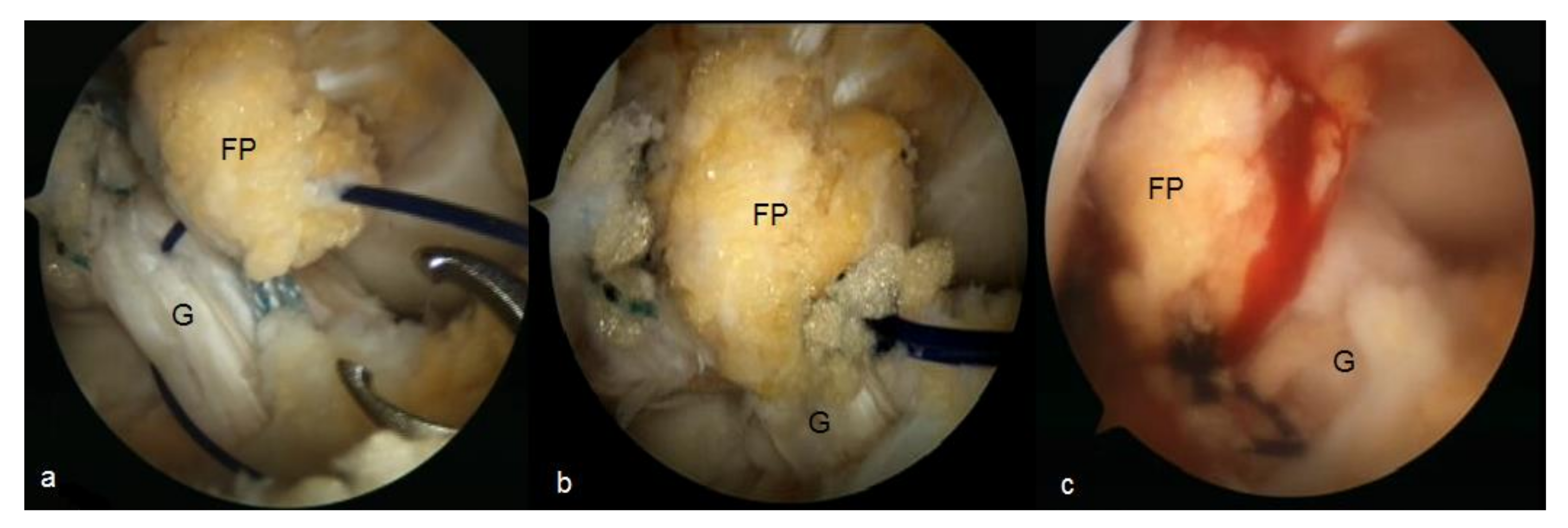 Applsci 11 03597 g004 Applsci 11 03597 g004