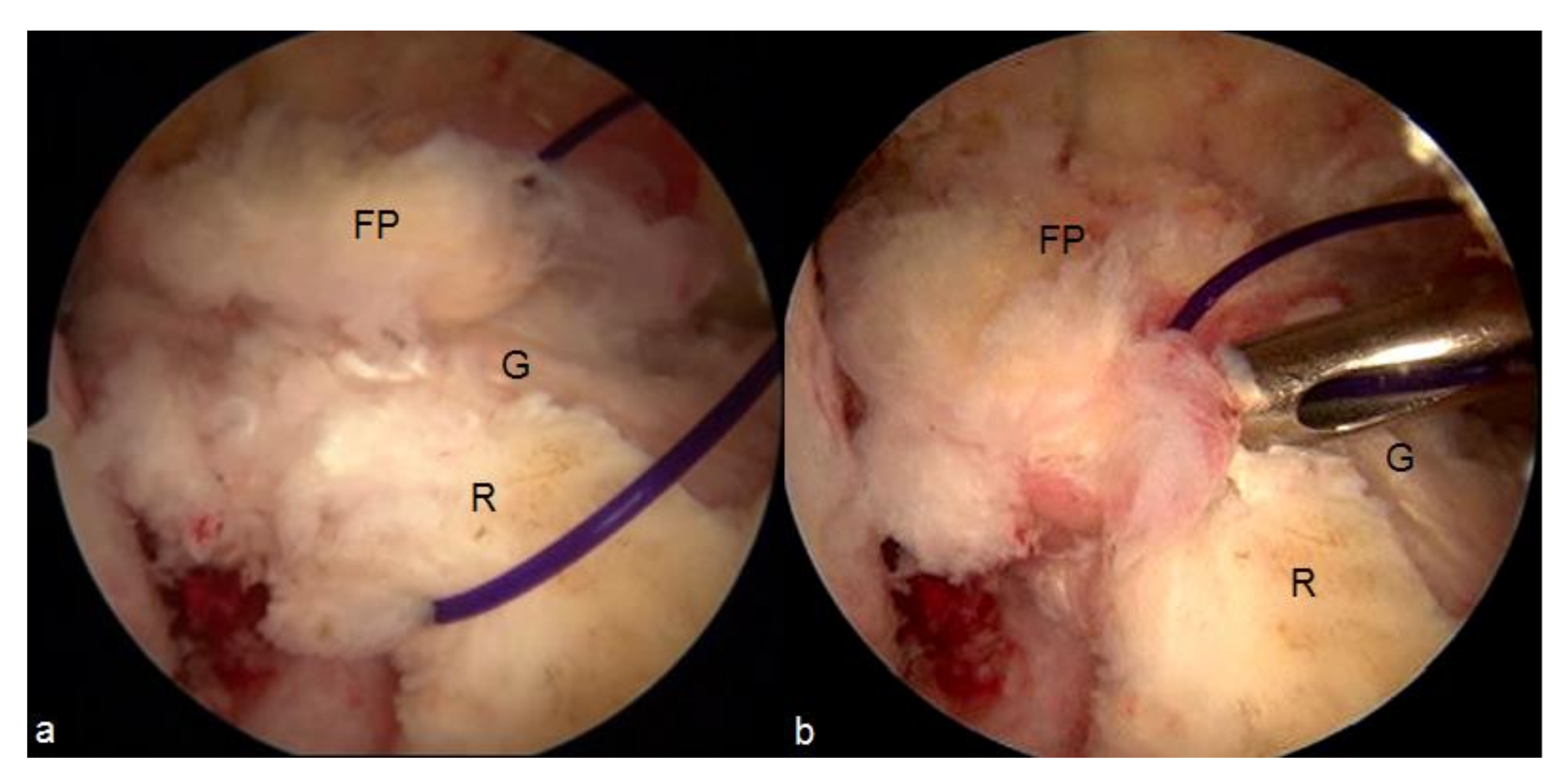 Applsci 11 03597 g005 Applsci 11 03597 g005