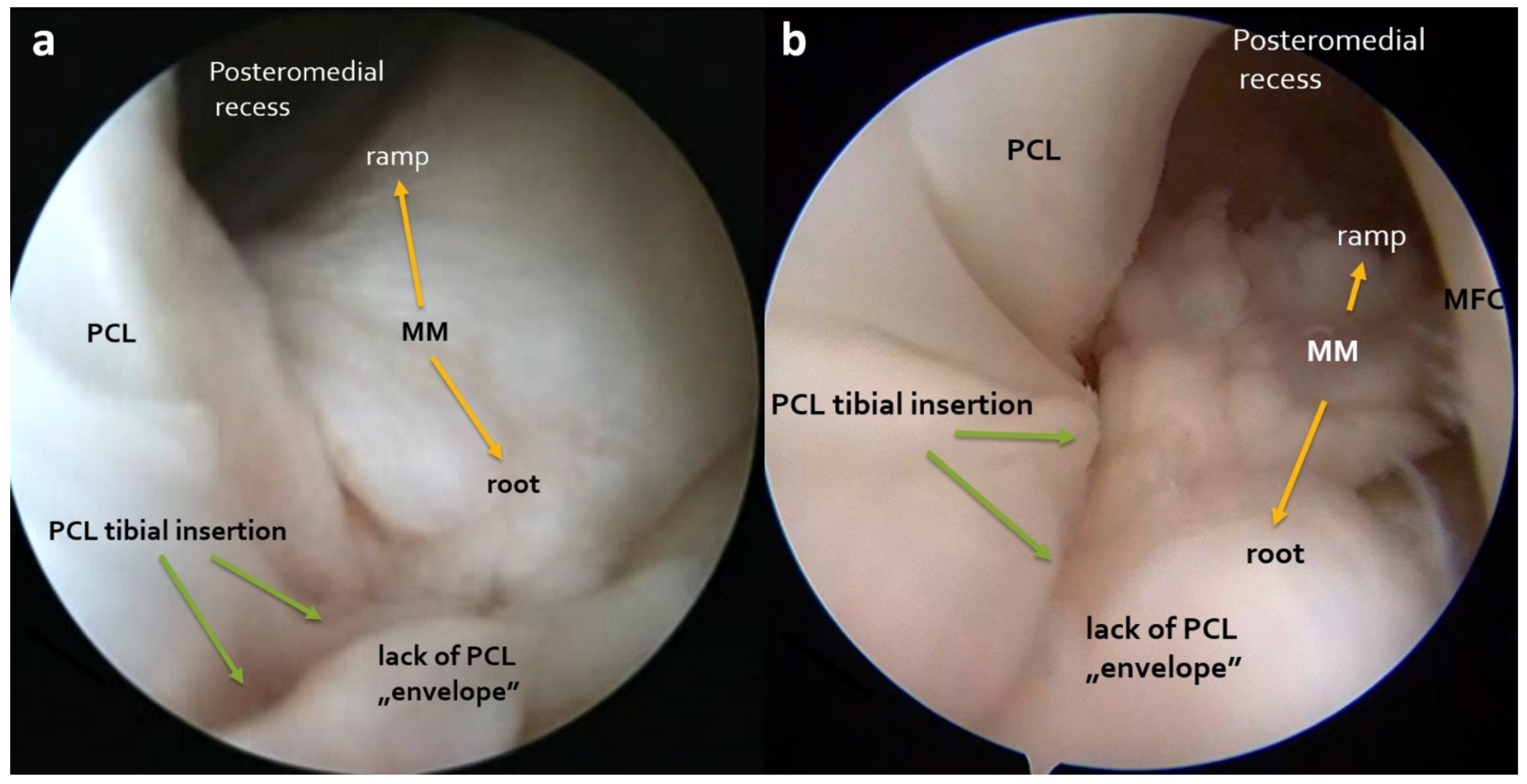 Applsci 11 03608 g002