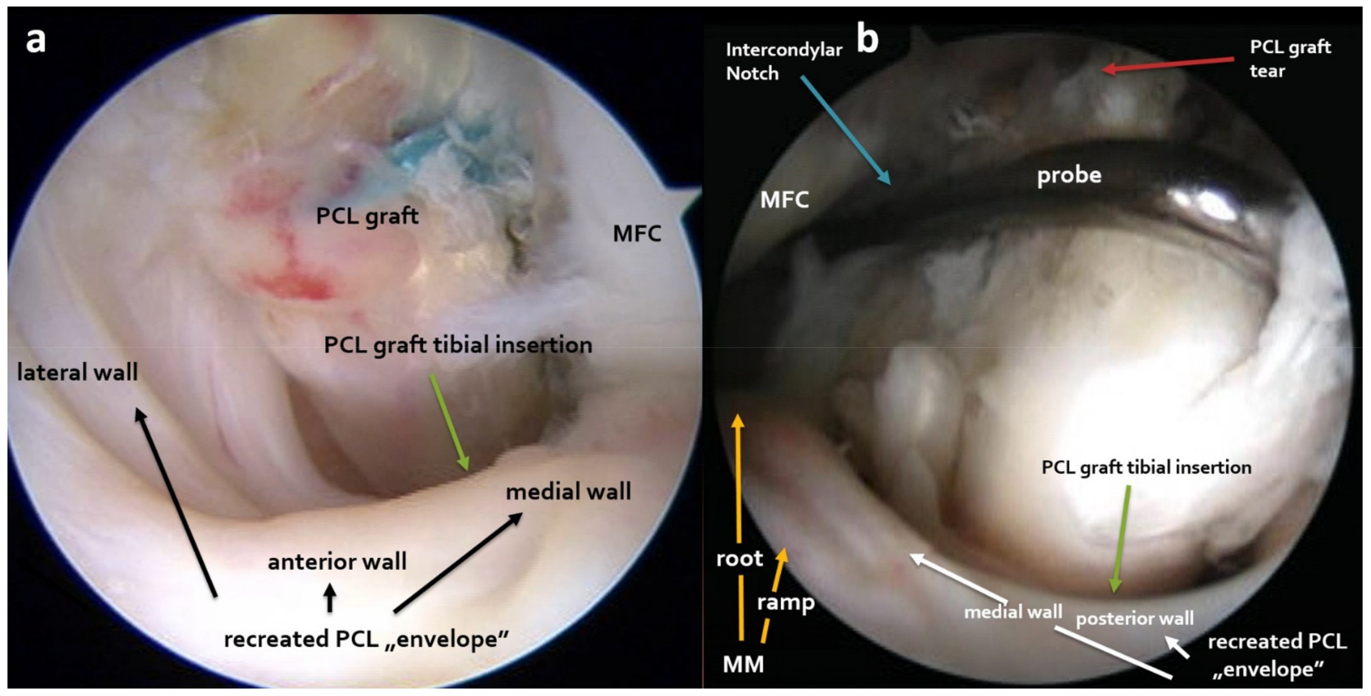 Applsci 11 03608 g003