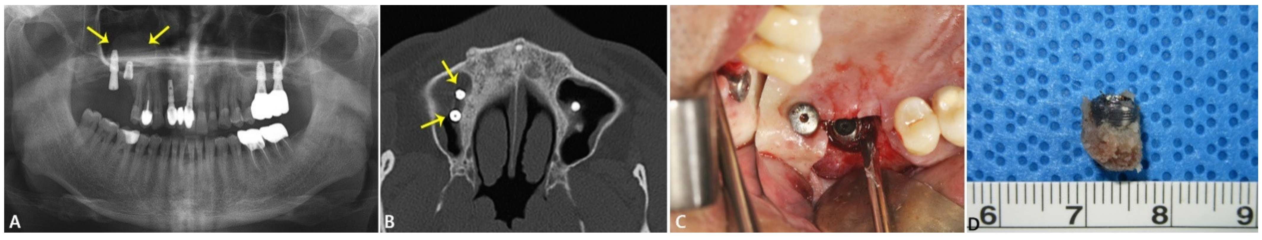 Applsci 11 03684 g001