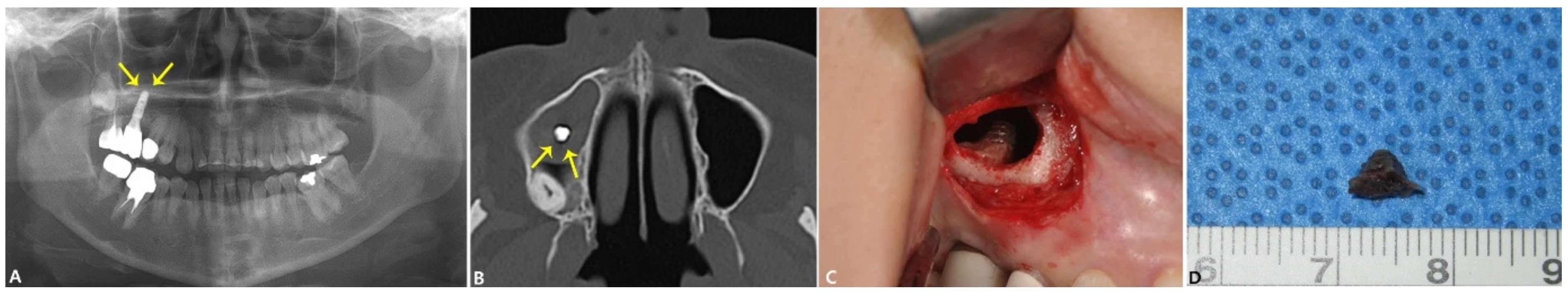 Applsci 11 03684 g003