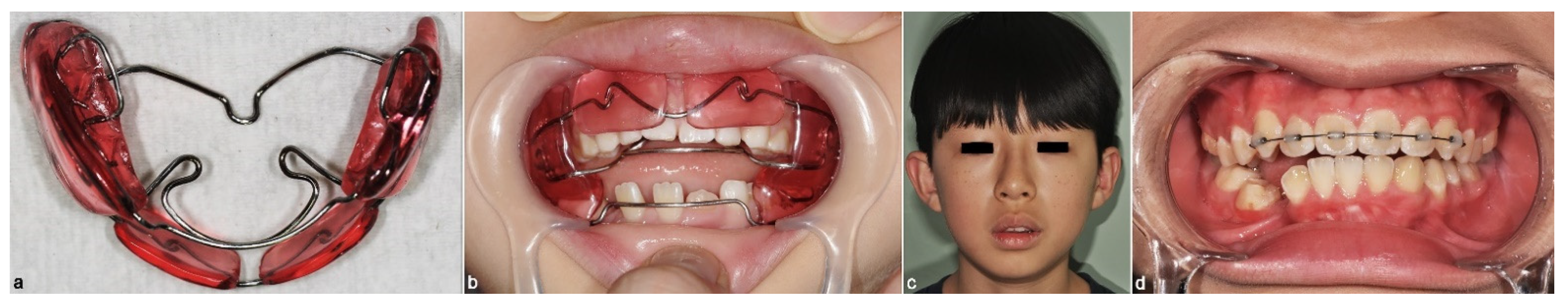 Applsci 11 03775 g005 Applsci 11 03775 g005