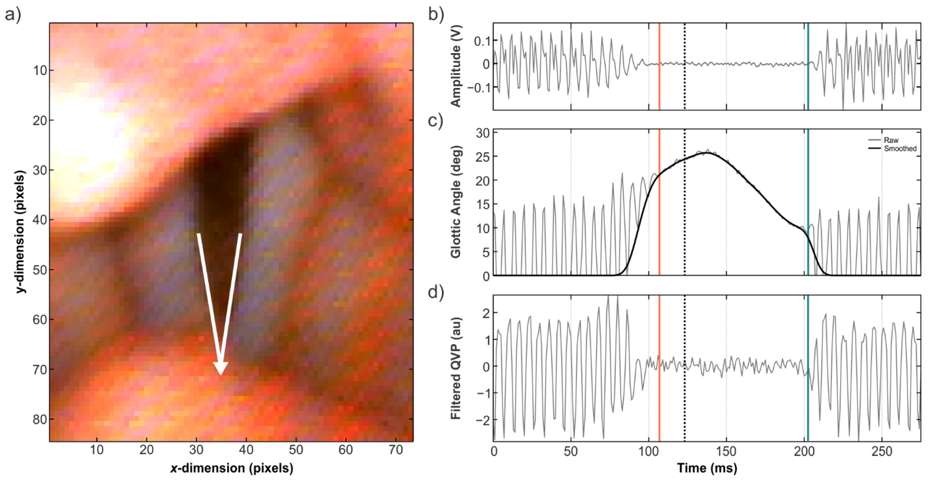 Applsci 11 03816 g002 Applsci 11 03816 g002