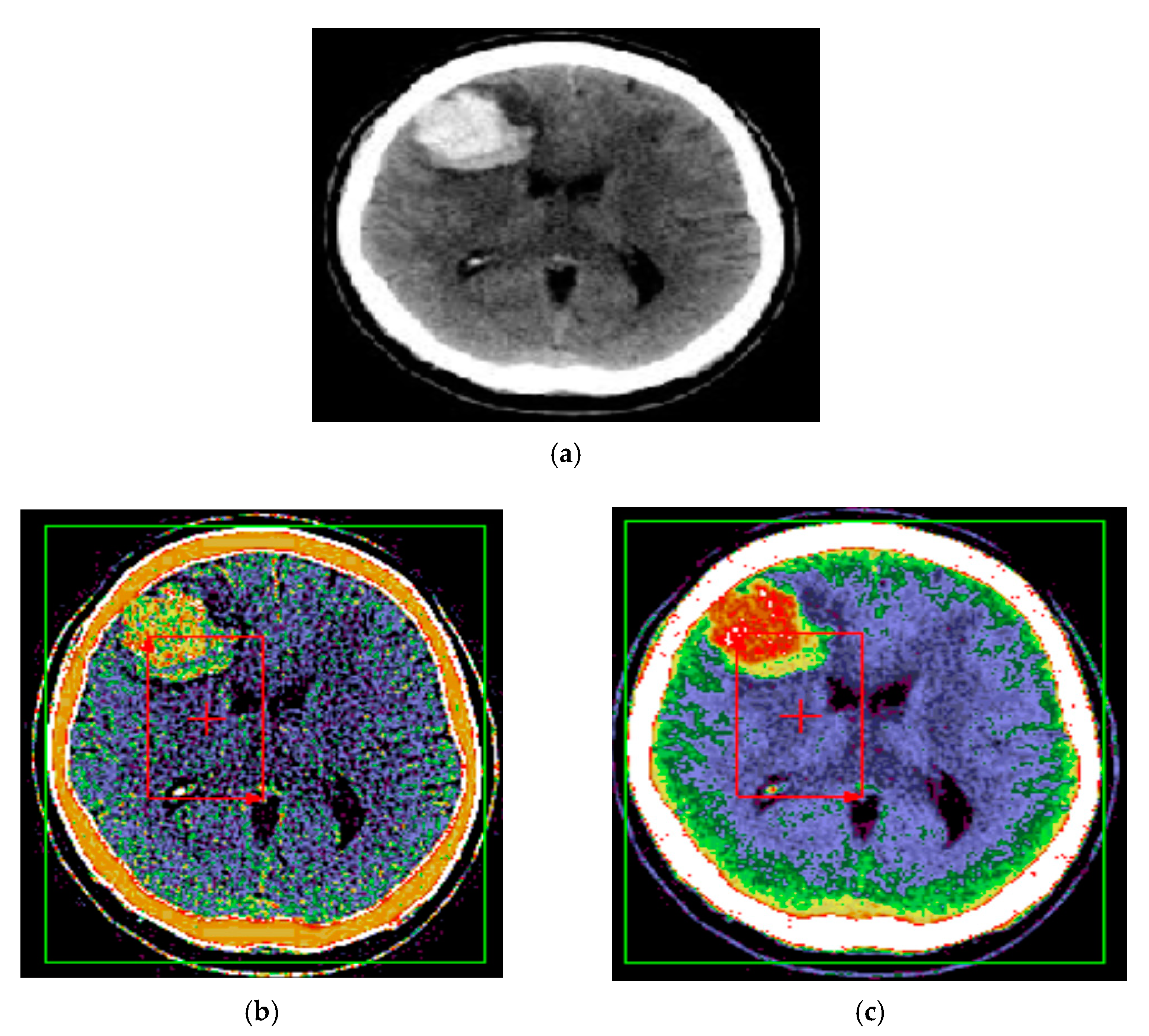 Applsci 11 03895 g008